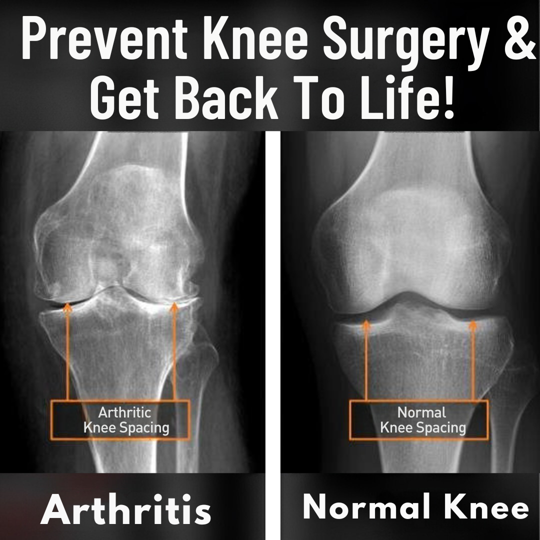 Active Spine and Joint Institute Facebook ad: Chronic Knee Pain Treatment In South Jersey!