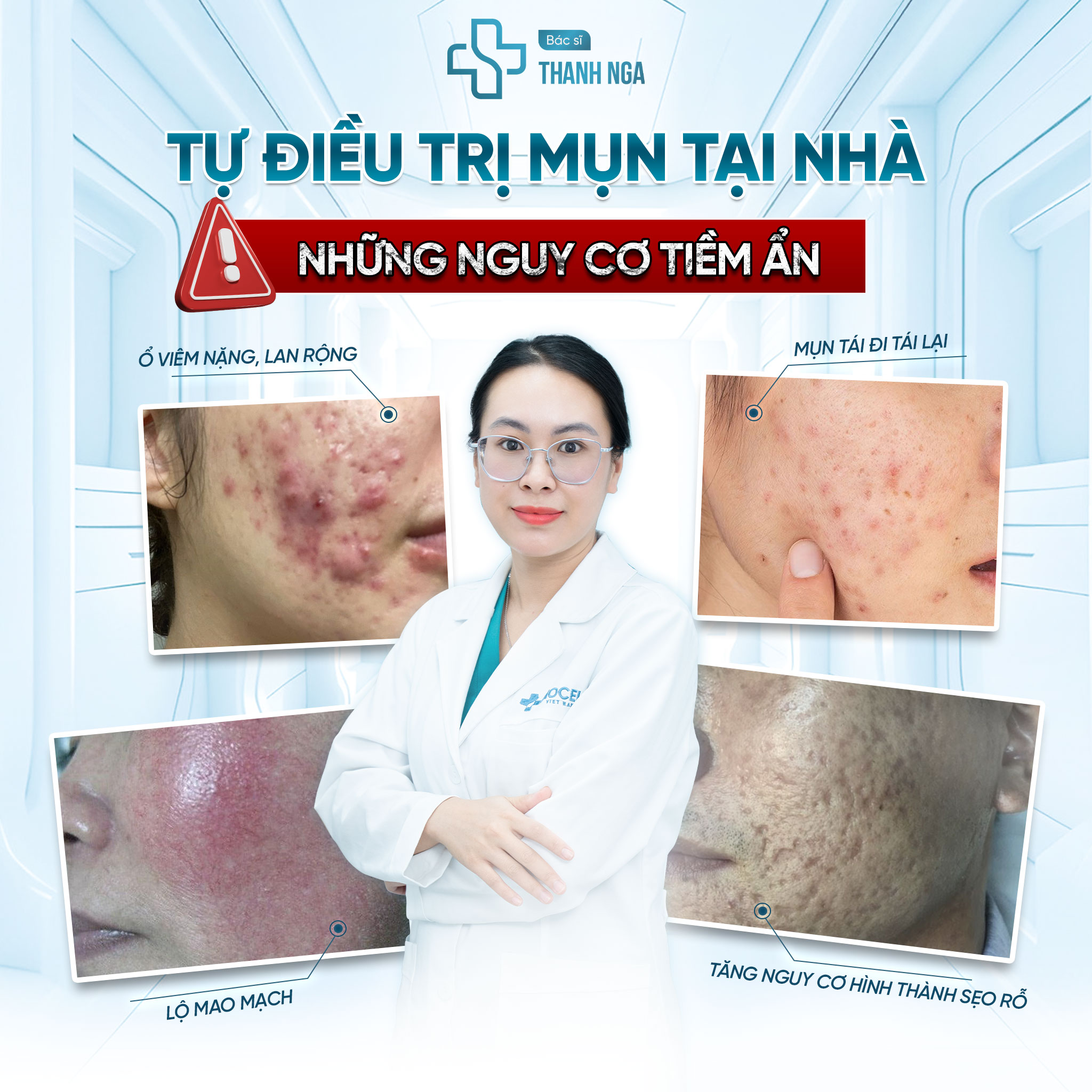 BS Thanh Nga - Điều Trị Mụn Chuẩn Y Khoa Facebook ad: CẢNH BÁO: ĐỪNG TỰ Ý ĐIỀU TRỊ MỤN…