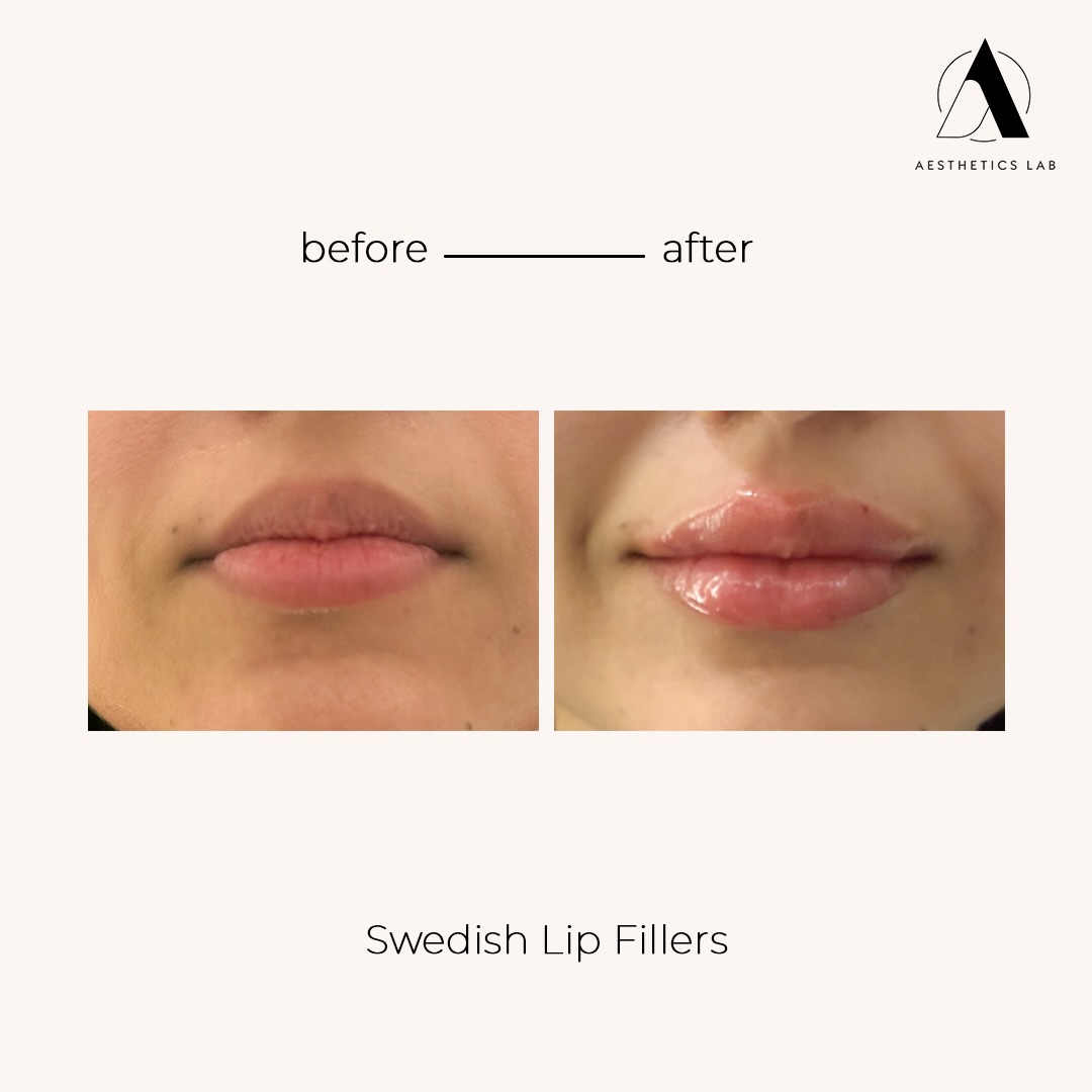 Aesthetics Lab by Tibbi Facebook ad