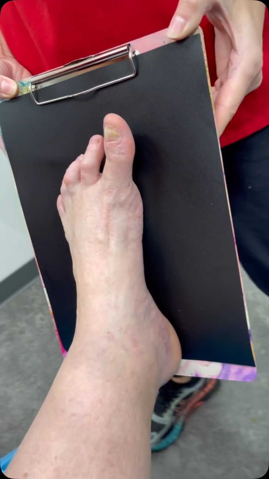 Foot First Podiatry Centers Facebook ad: Waiting for a final surgical result is not…