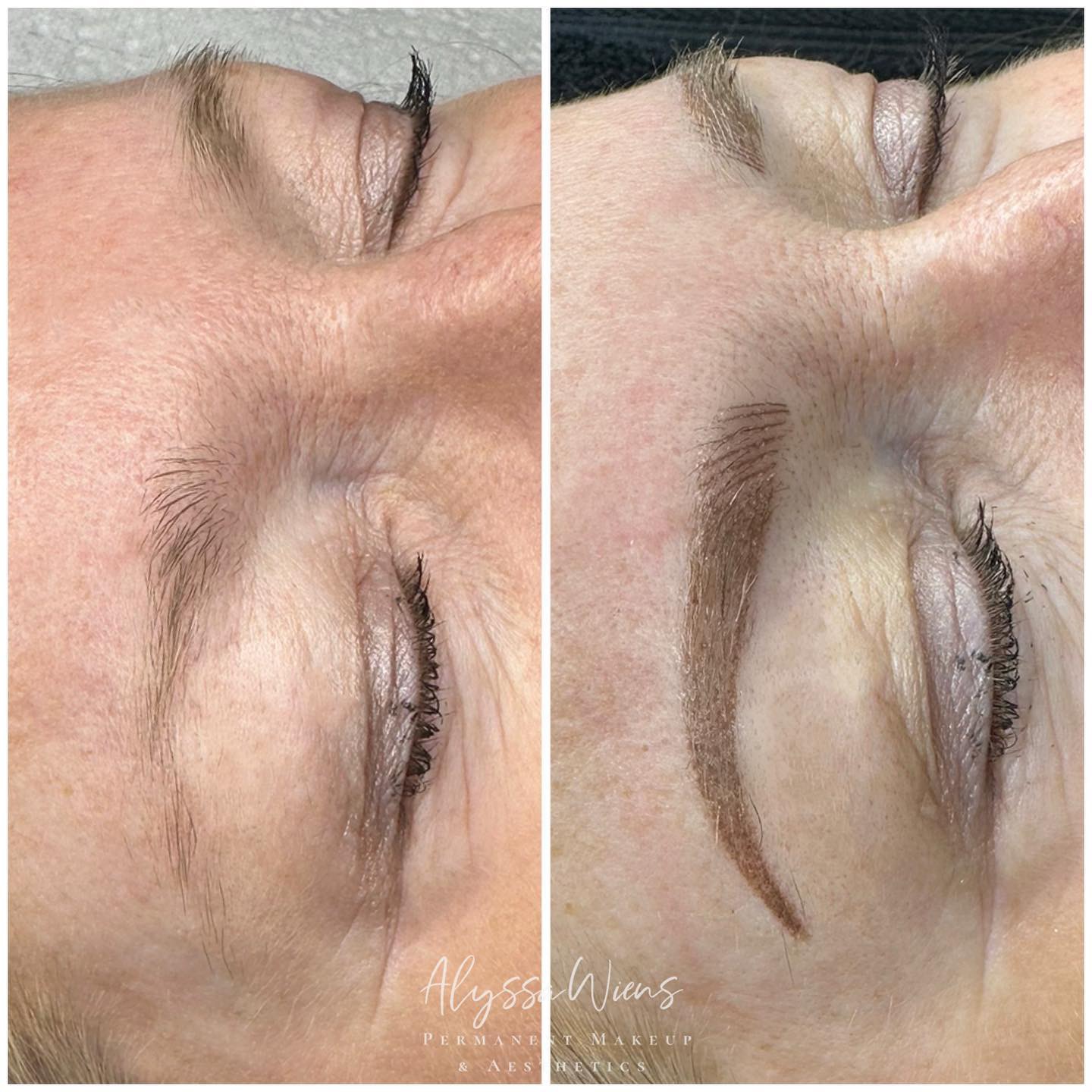 AlyssaWiens Laser & Aesthetics Facebook ad