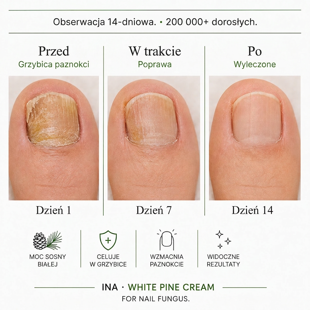 Kosmetyki Organiczne - InaEssentials.pl Facebook ad: Dzień 1 vs dzień 14: różnica jest realna.