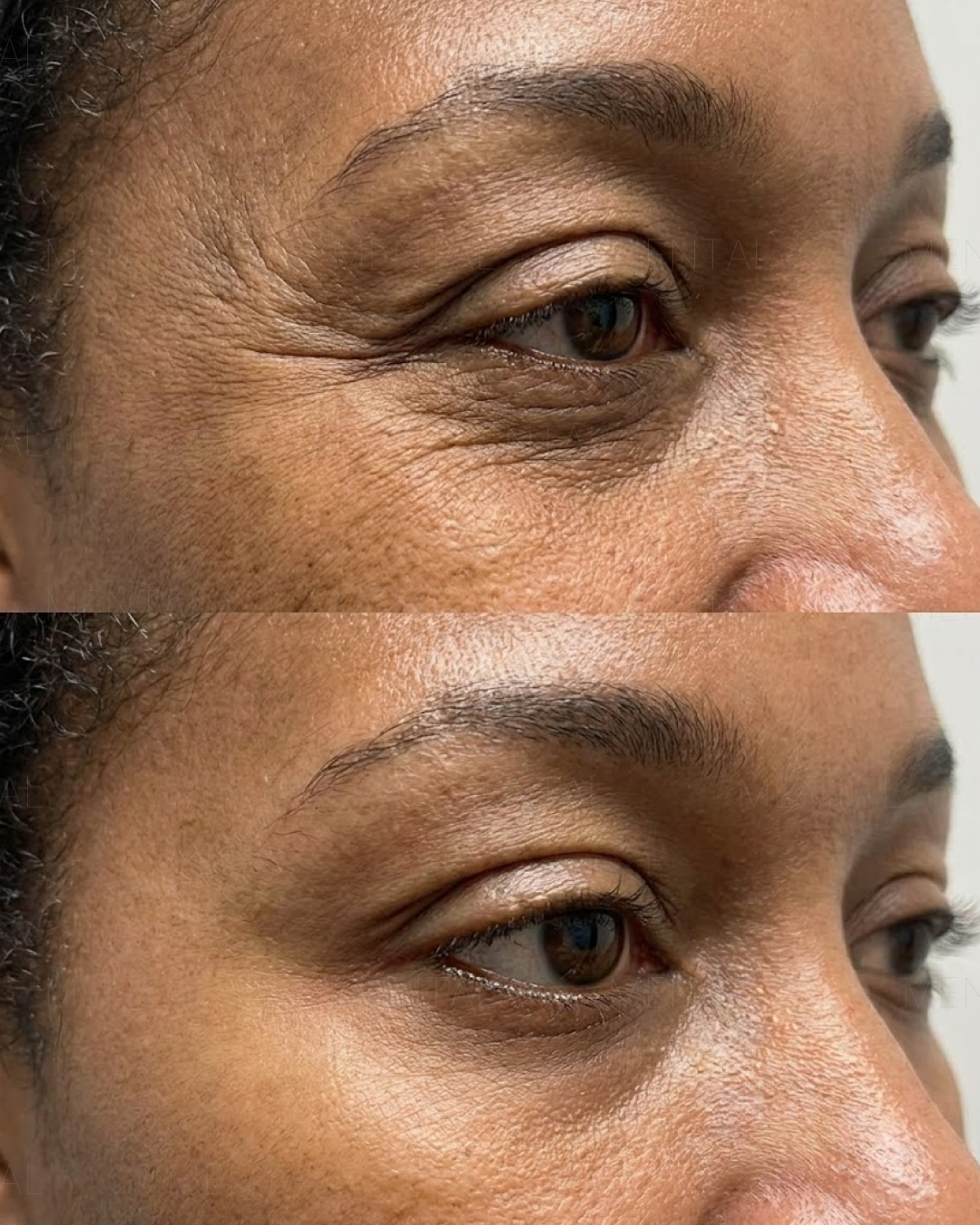 Mimika - Face Yoga Exercises Facebook ad