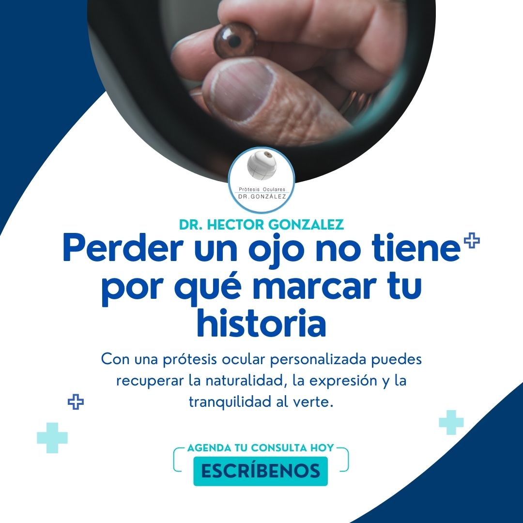 Prótesis Oculares Dr. Gonzalez Ecuador Facebook ad: Recupera tu expresión con una prótesis ocular personalizada