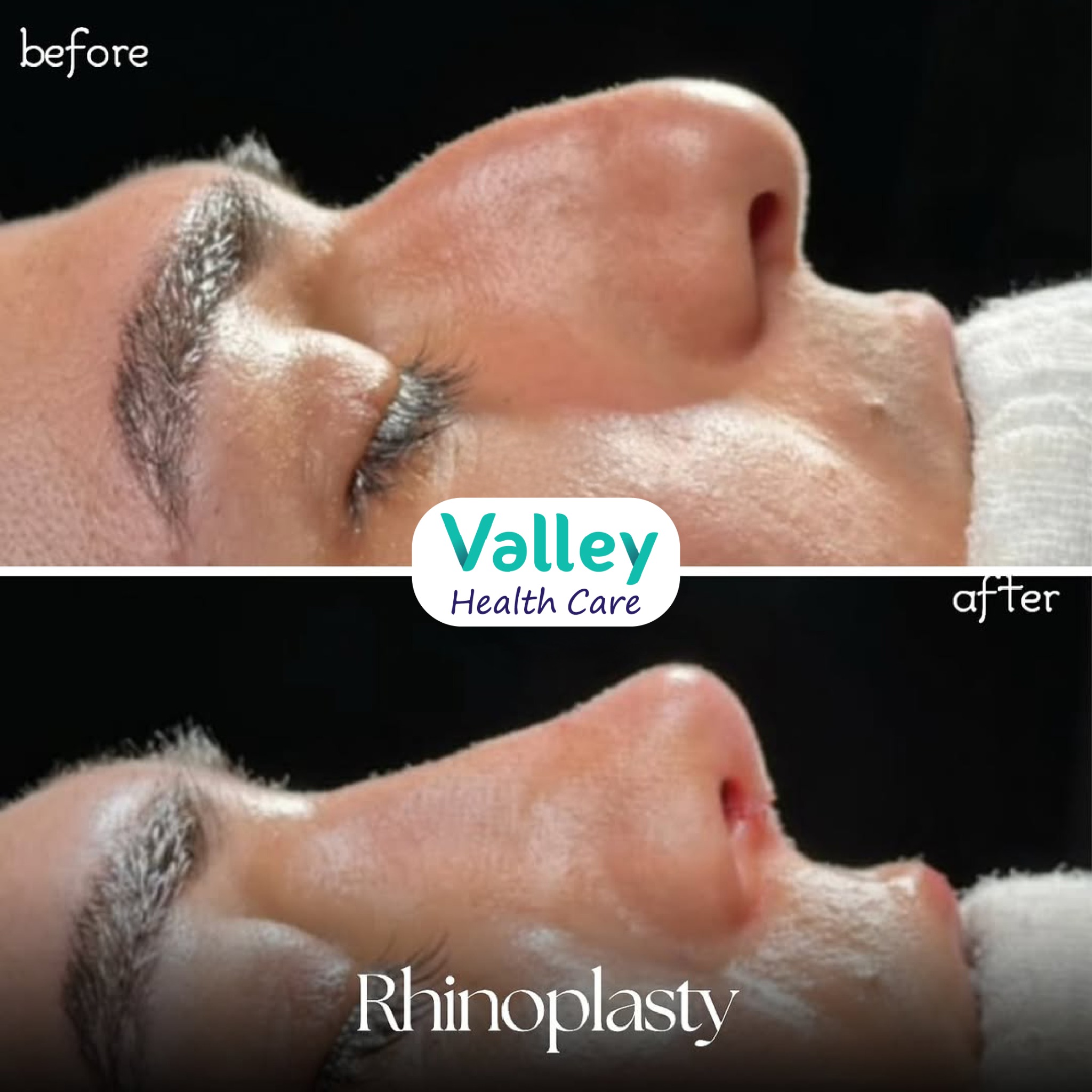 Valley Clinic Turkey Facebook ad