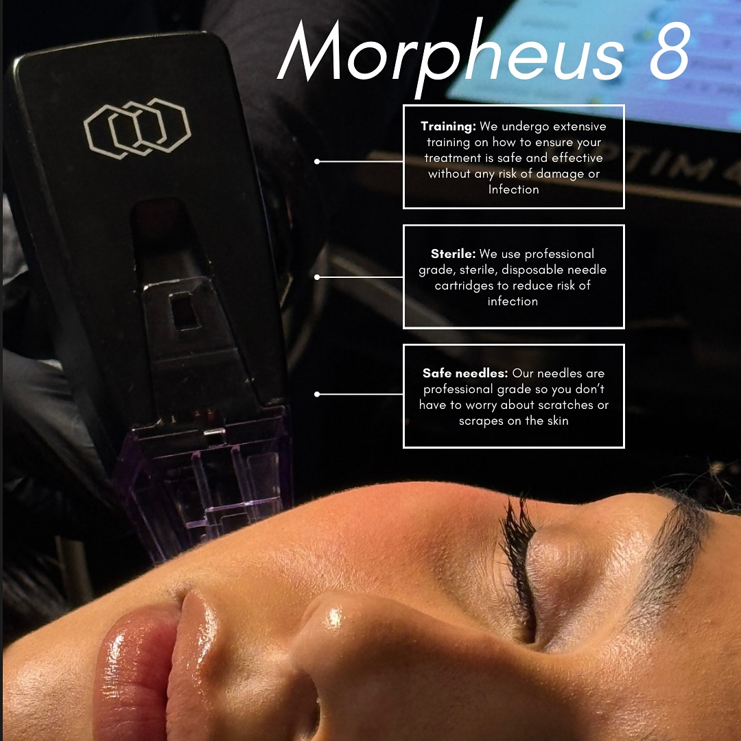 Labelleviemedspa Facebook ad