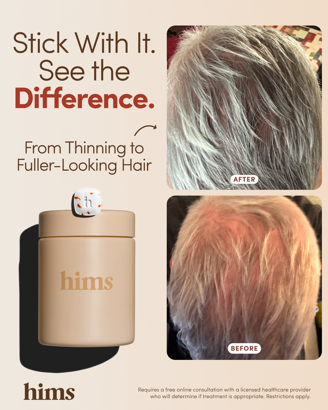 hims Facebook ad