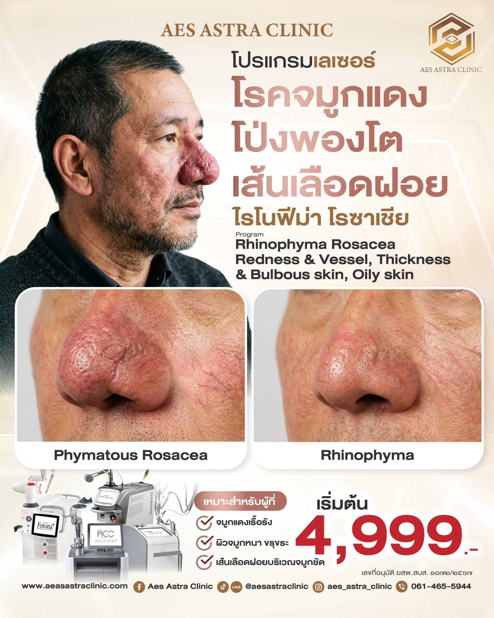 Aes Astra Clinic Facebook ad