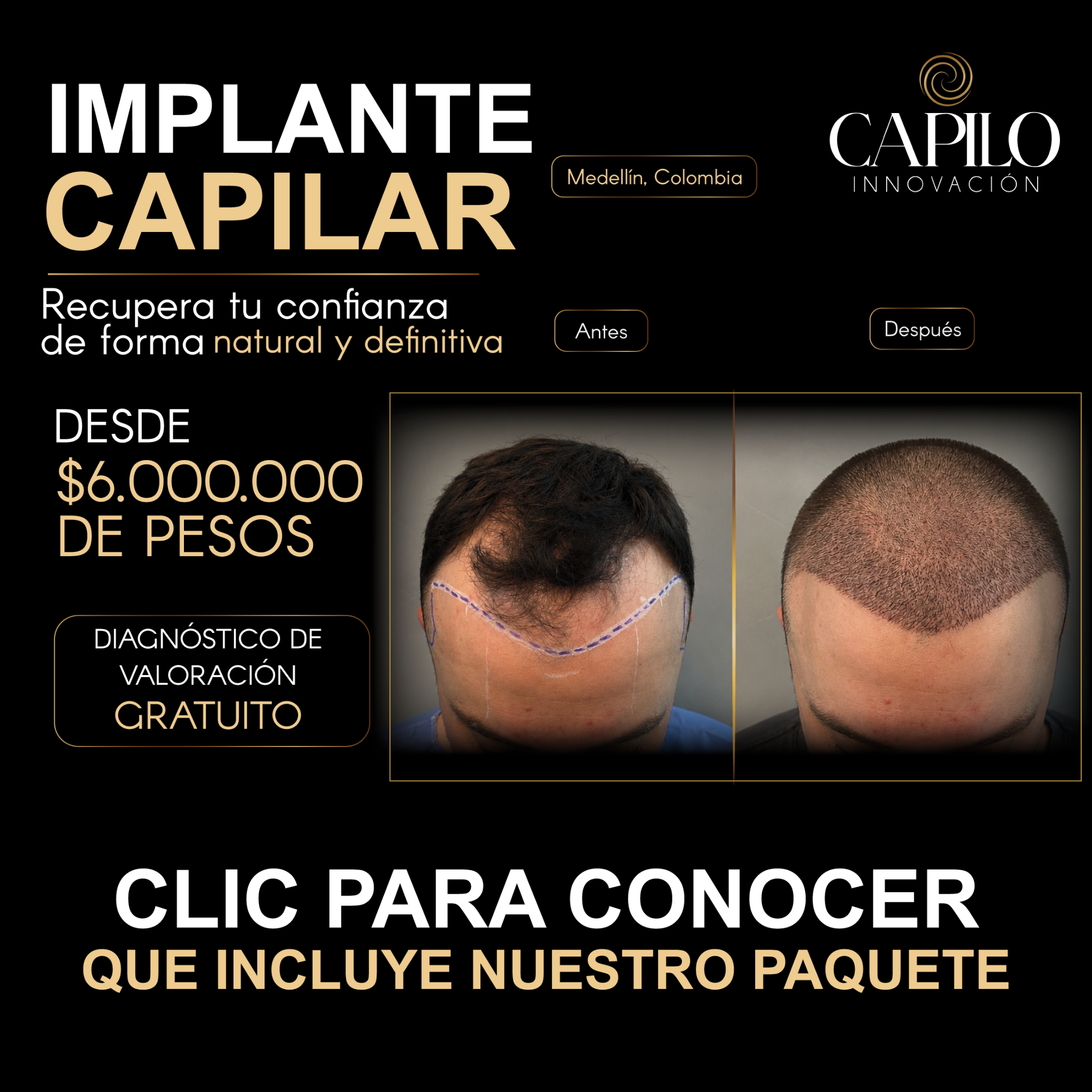 Capilo Innovación Facebook ad: Chatea con nosotros