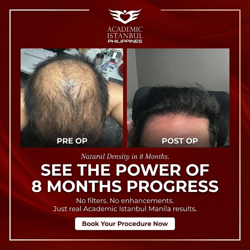 Academic Istanbul Hair Clinic Manila Facebook ad: Results that speak louder than words.