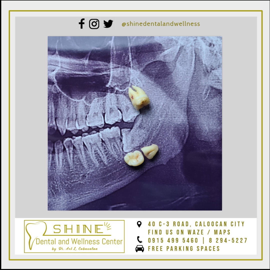 Shine Dental and Wellness Center Facebook ad: Visit the town’s premier clinic. Message for appointments…