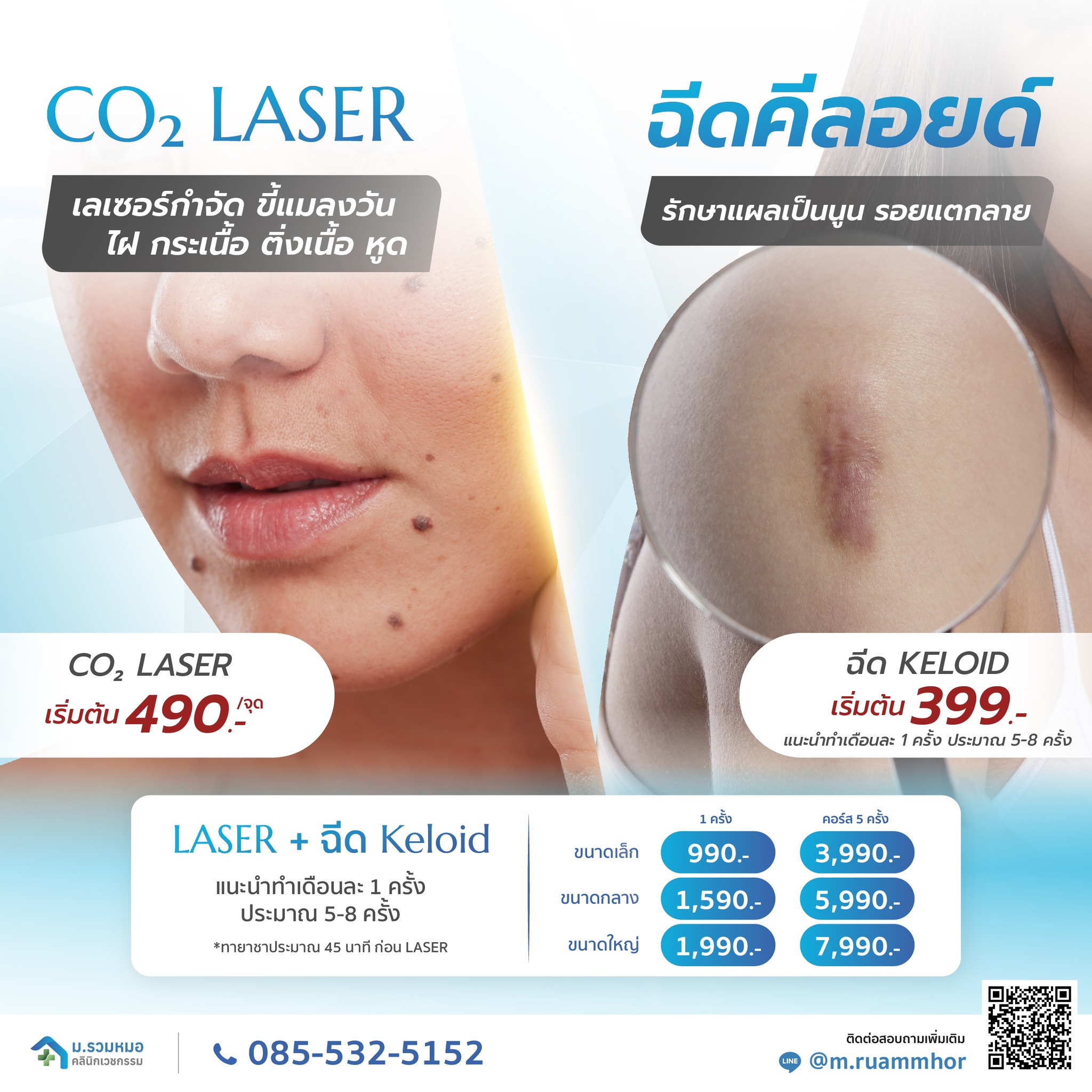 ม.รวมหมอ x ม.รวมหมอฟัน คลินิก Facebook ad: ไฝ ขี้แมลงวัน ติ่งเนื้อ กระเนื้อ หูด สิวหิน