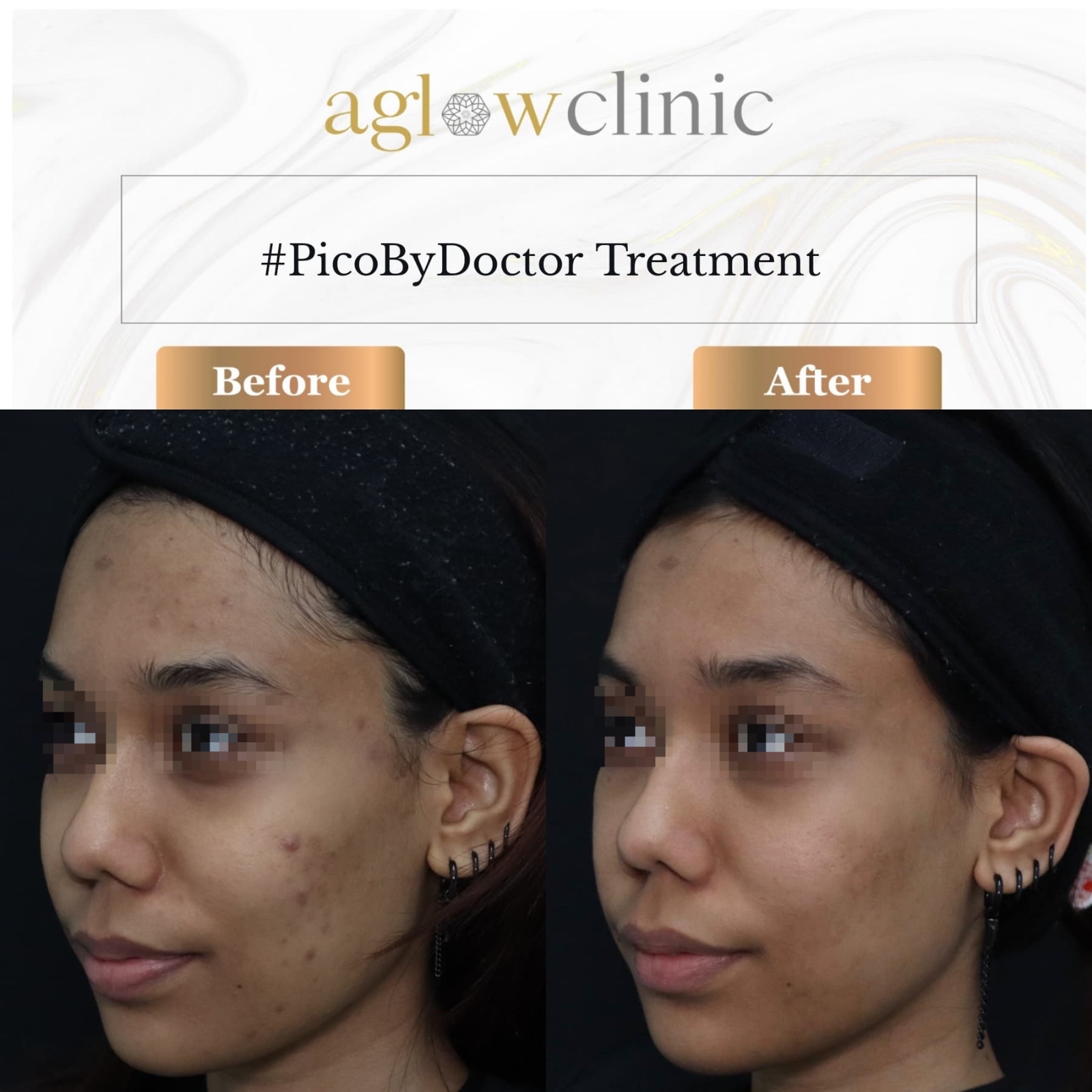 Aglow Clinic Facebook ad
