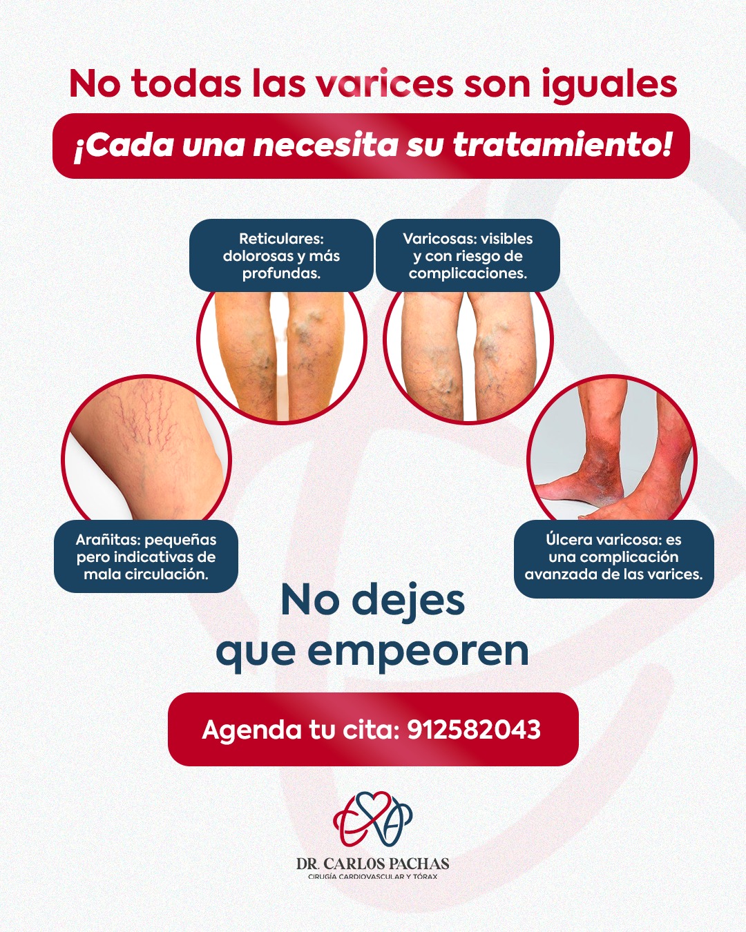 Dr. Carlos Pachas - Cirujano Cardiovascular Facebook ad: ¿Todas las várices son iguales?