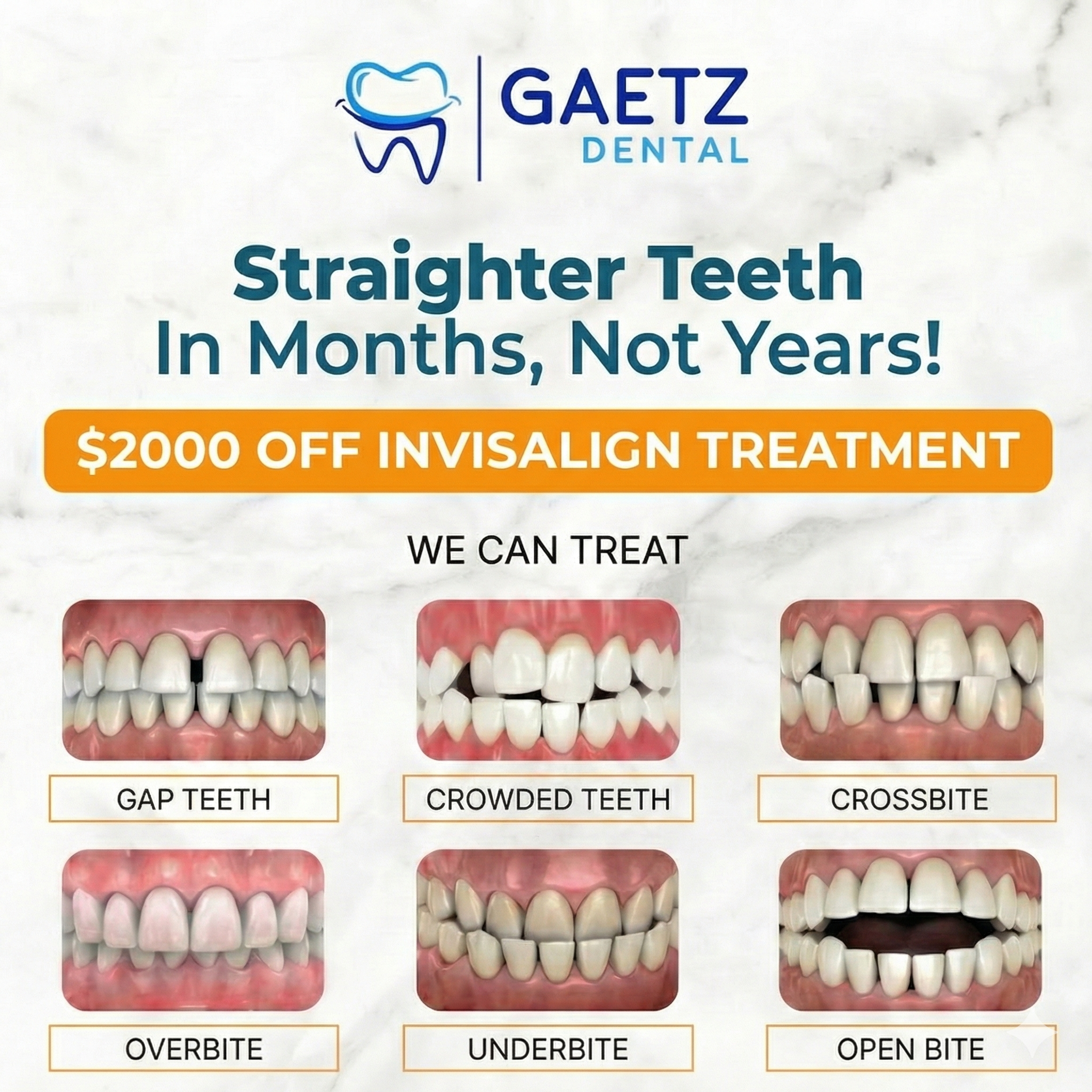 Gaetz Dental Facebook ad: Hello, Red Deer! $2000 OFF Invisalign Special is here!