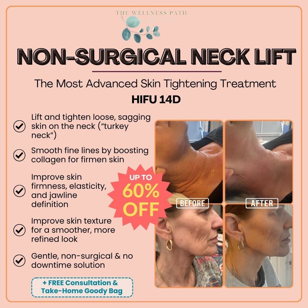 The Wellness Path Facebook ad: Non-Surgical Necklift - Just £149