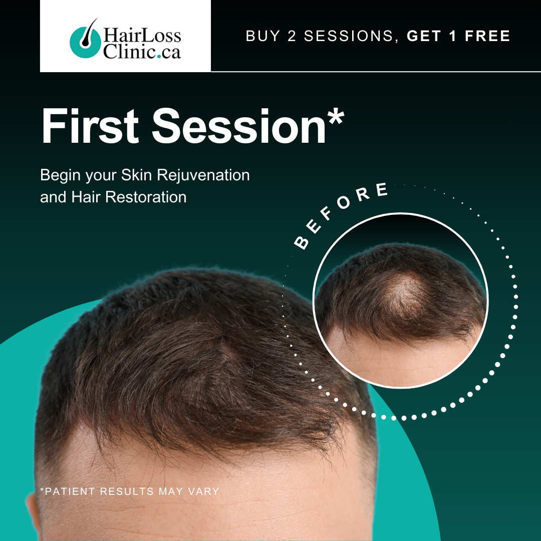LaserSkin.ca Facebook ad: Unlock Hair Growth and Skin Rejuvenation with PRP