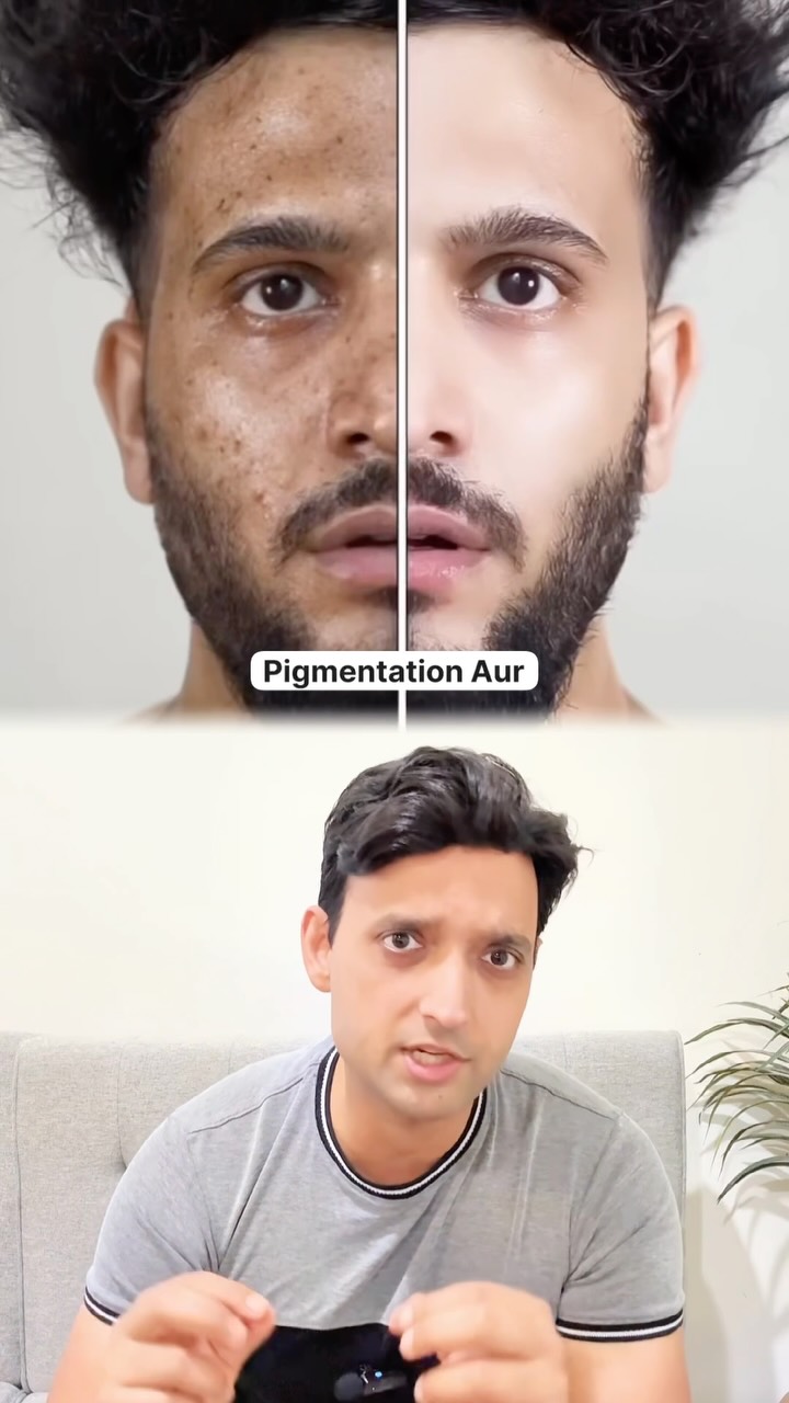 tena_rajawat Facebook ad: Dhoop ki wajah se tanning, pigmentation aur dull…