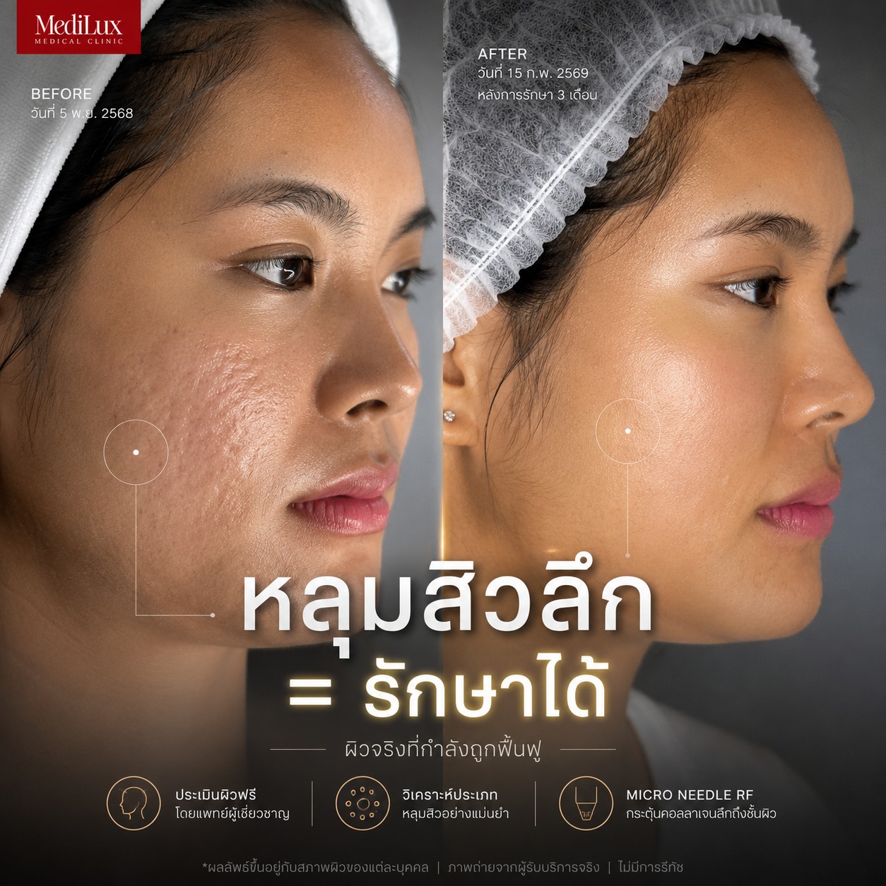 MediLux Medical Clinic - เมดิลักษม์ เมดิคอลคลินิก เชียงใหม่ Facebook ad