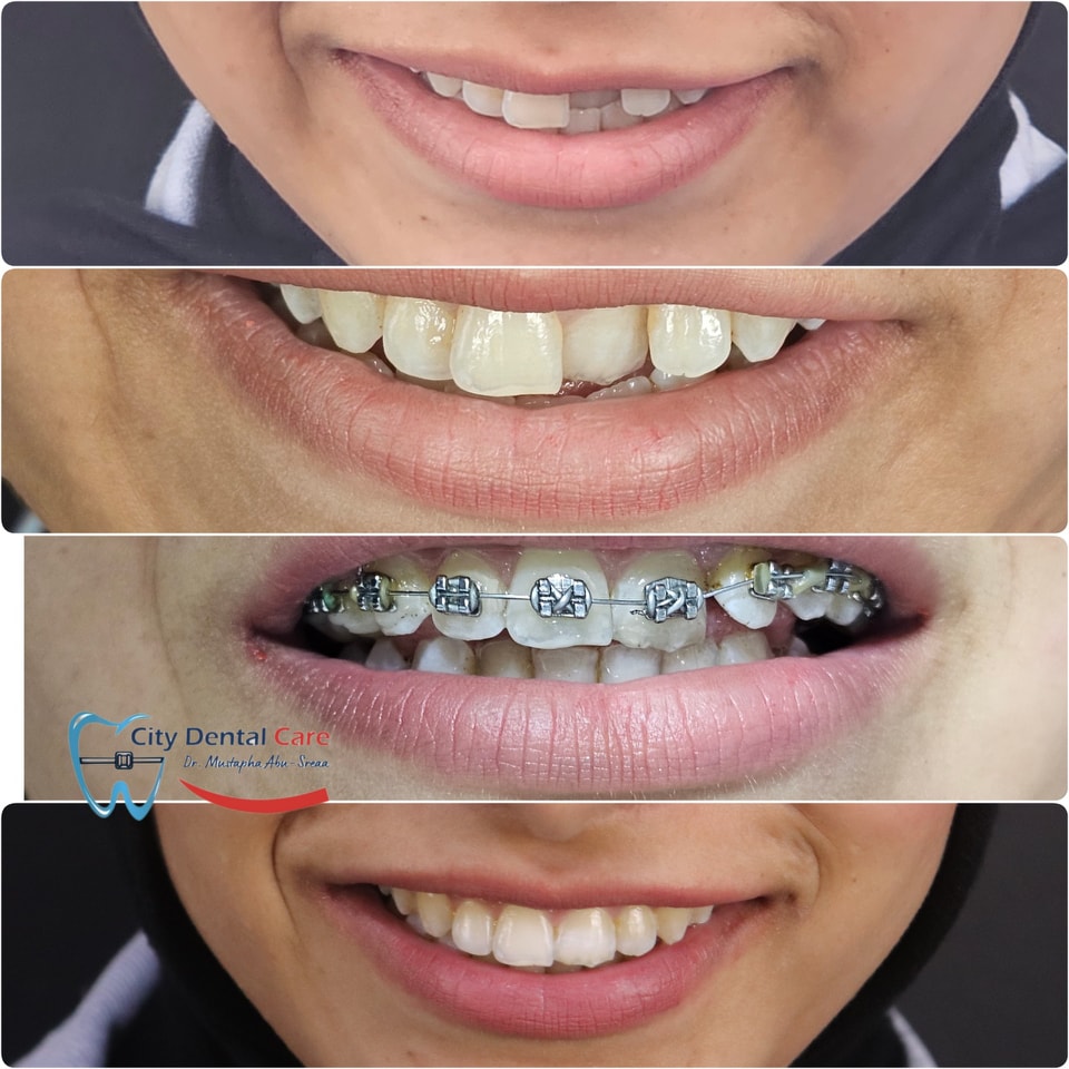 Dr.Mustapha Ali - City Dental Care Facebook ad: من اللخبطة للثقة.في ١٢ شهر!
