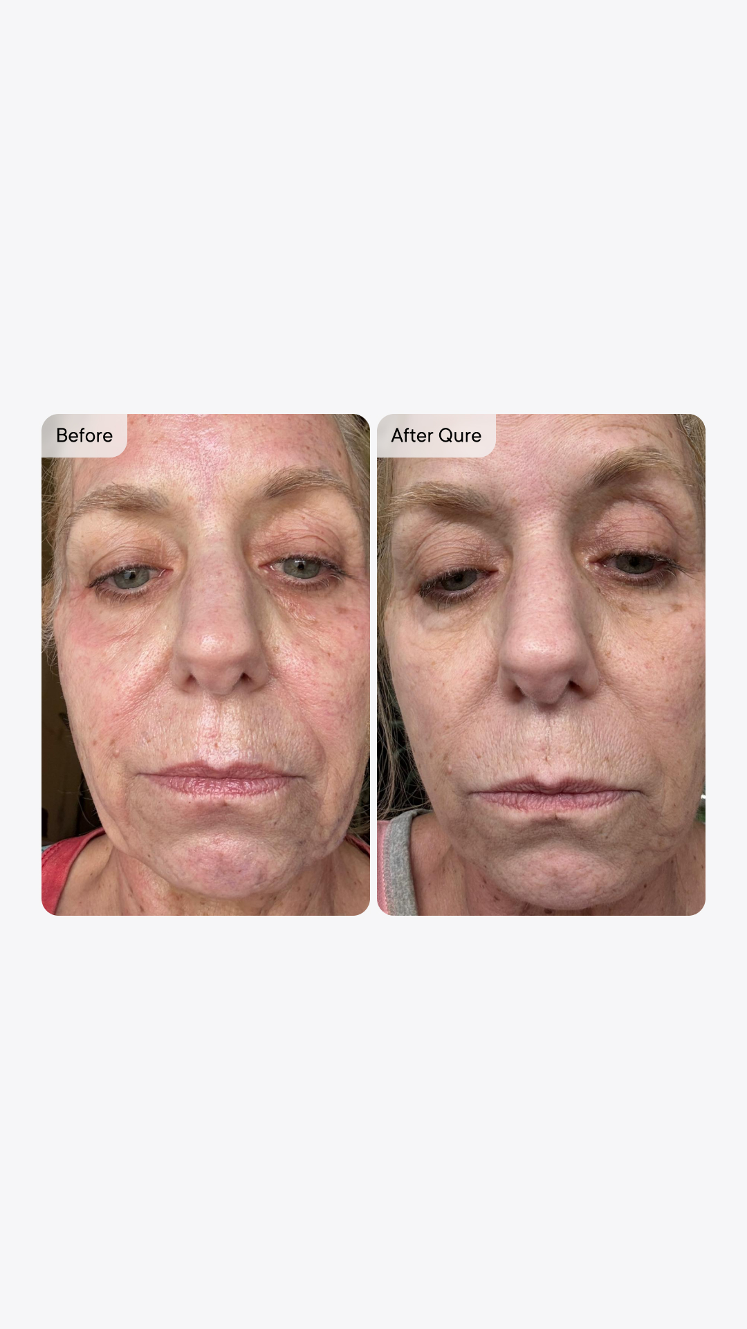 Qure Skincare Facebook ad