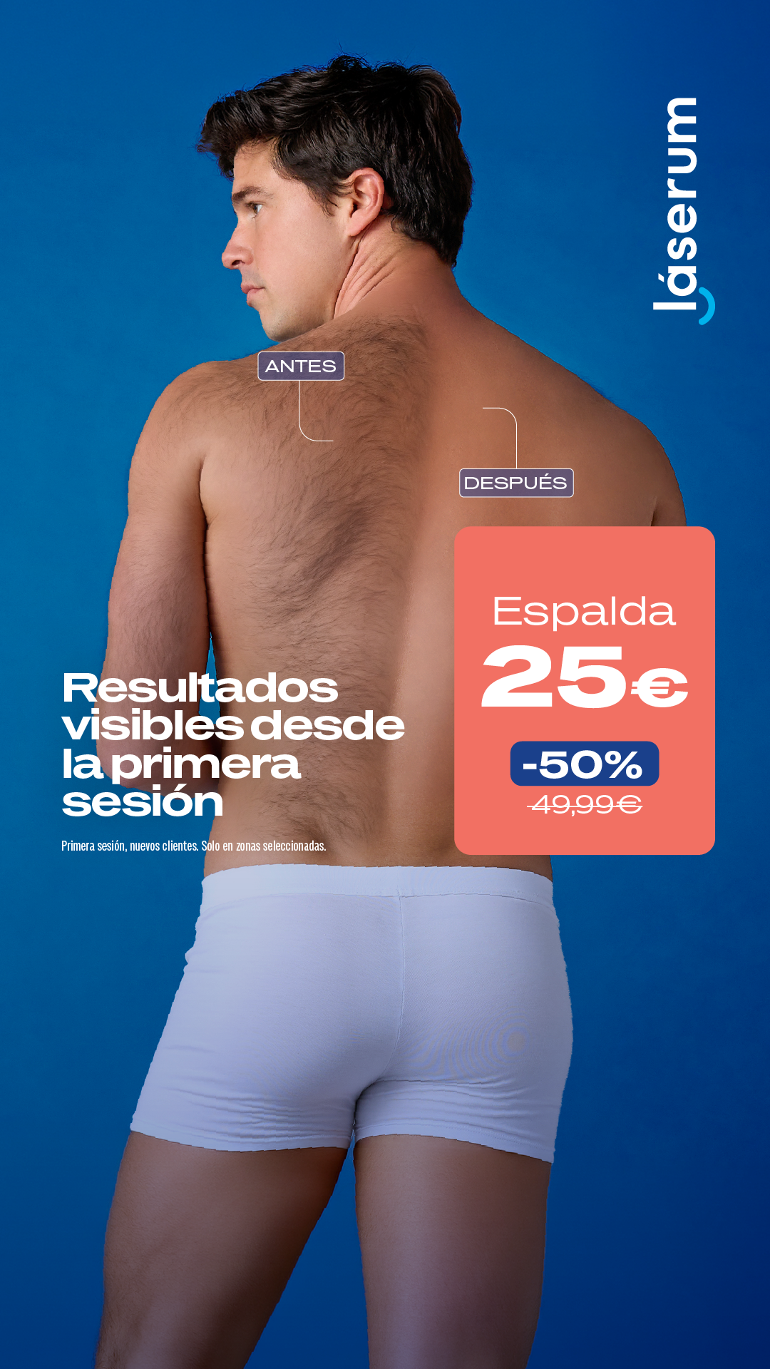 Láserum Facebook ad: Tu primera sesión al 50%