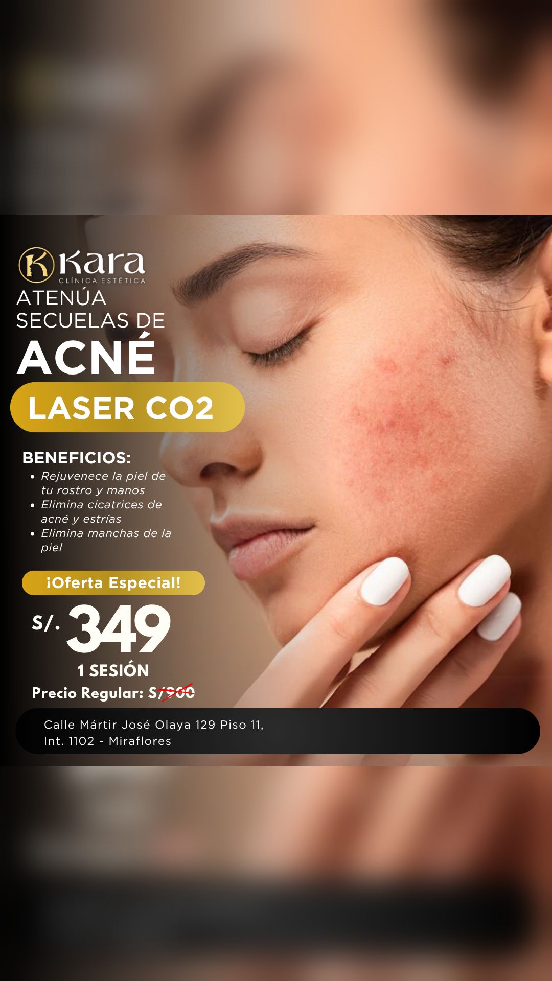 Kara - Clínica estética láser Facebook ad from May 15, 2026