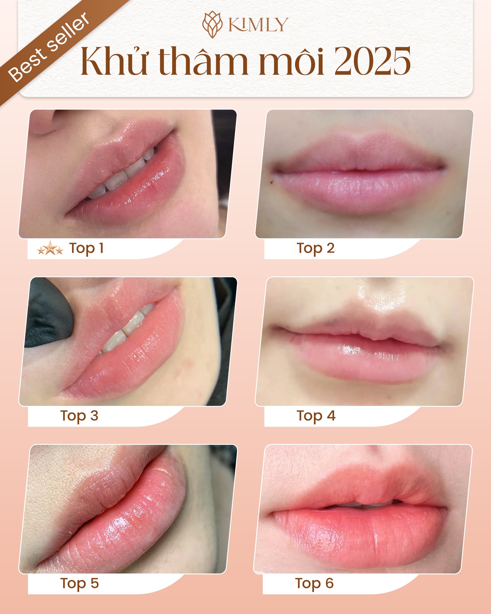 KIMLY Brows SaiGon - 58 Lê Thị Riêng Facebook ad: Nàng muốn có đôi môi tươi tắn, rạng…