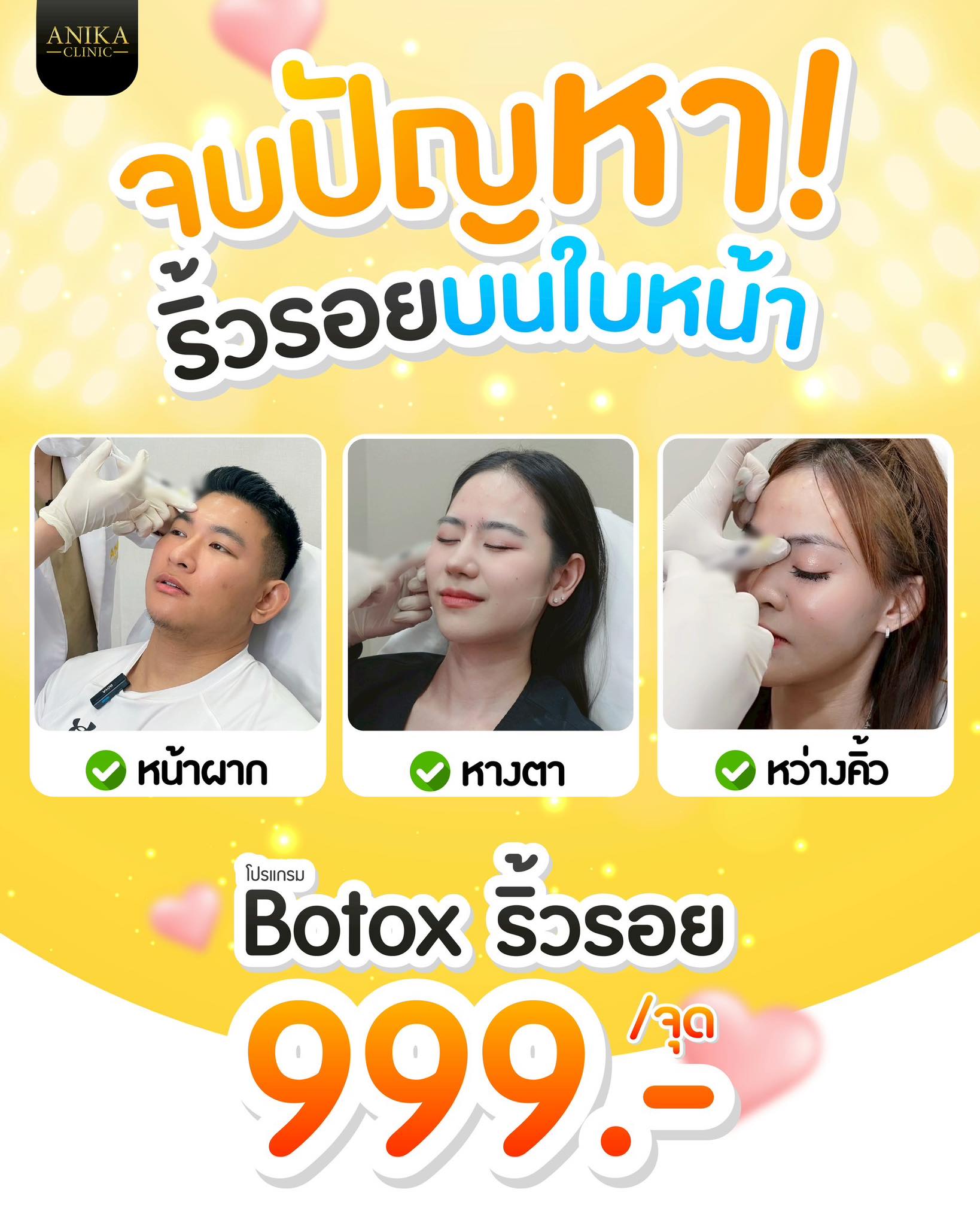 Anika Clinic โปรแกรมฉีดฟิลเล่อร์ โบท็อกซ์ ปรับรูปหน้า Facebook ad