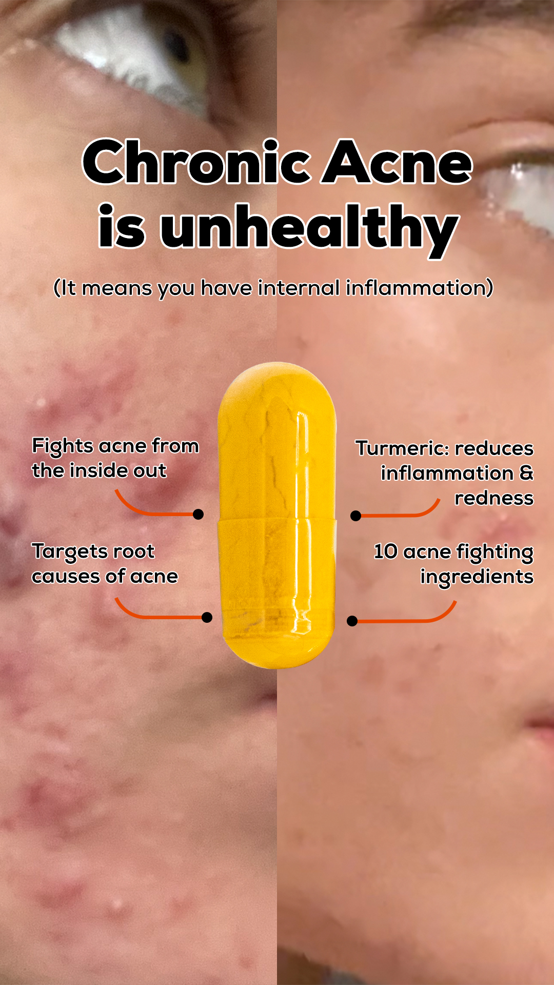 Within Skin Facebook ad