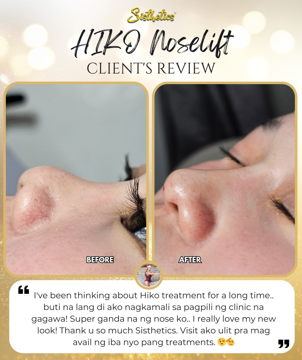 Sisthetics Facebook ad