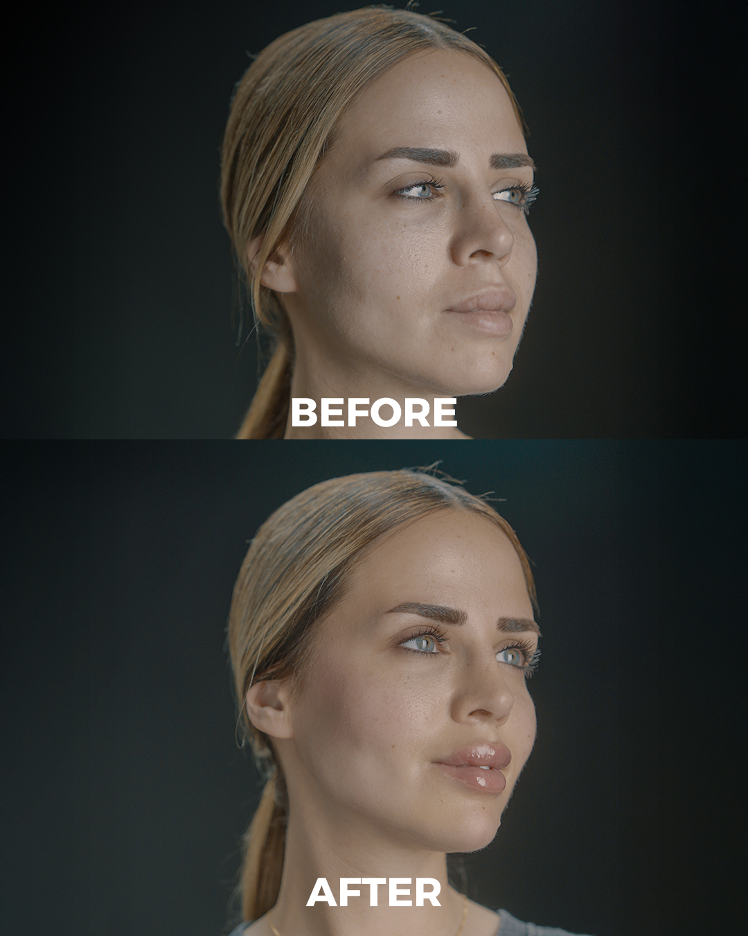 Telescope Derma - تلسكوب ديرما Facebook ad: في تلسكوب نهتم بإبراز جمالك الطبيعي لتكوني كما تحبي Chin…