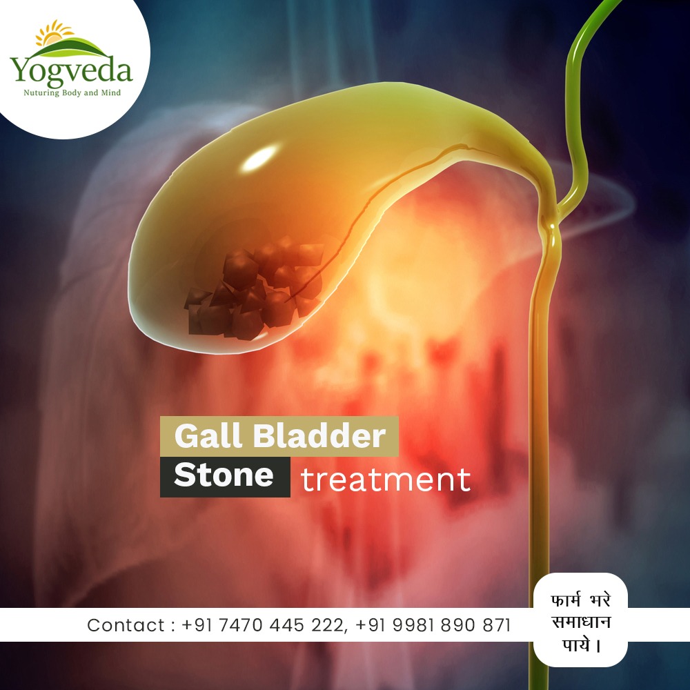 Yogveda Health Care Facebook ad