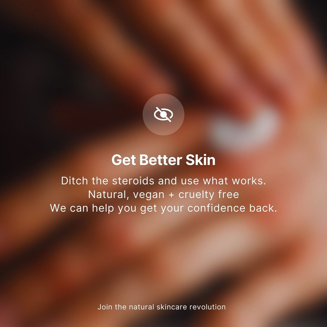 Thunderbird Natural Skincare - sensitive skin solutions Facebook ad