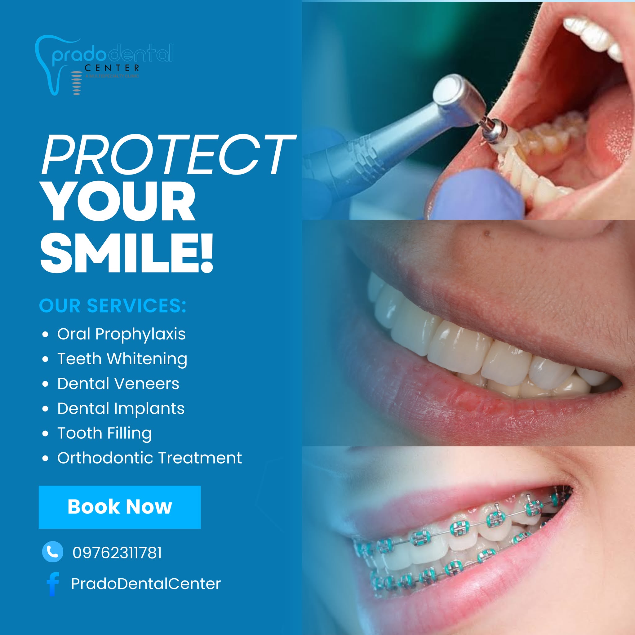 Prado Dental Center Facebook ad: We specialize in preventive care, cosmetic dentistry…