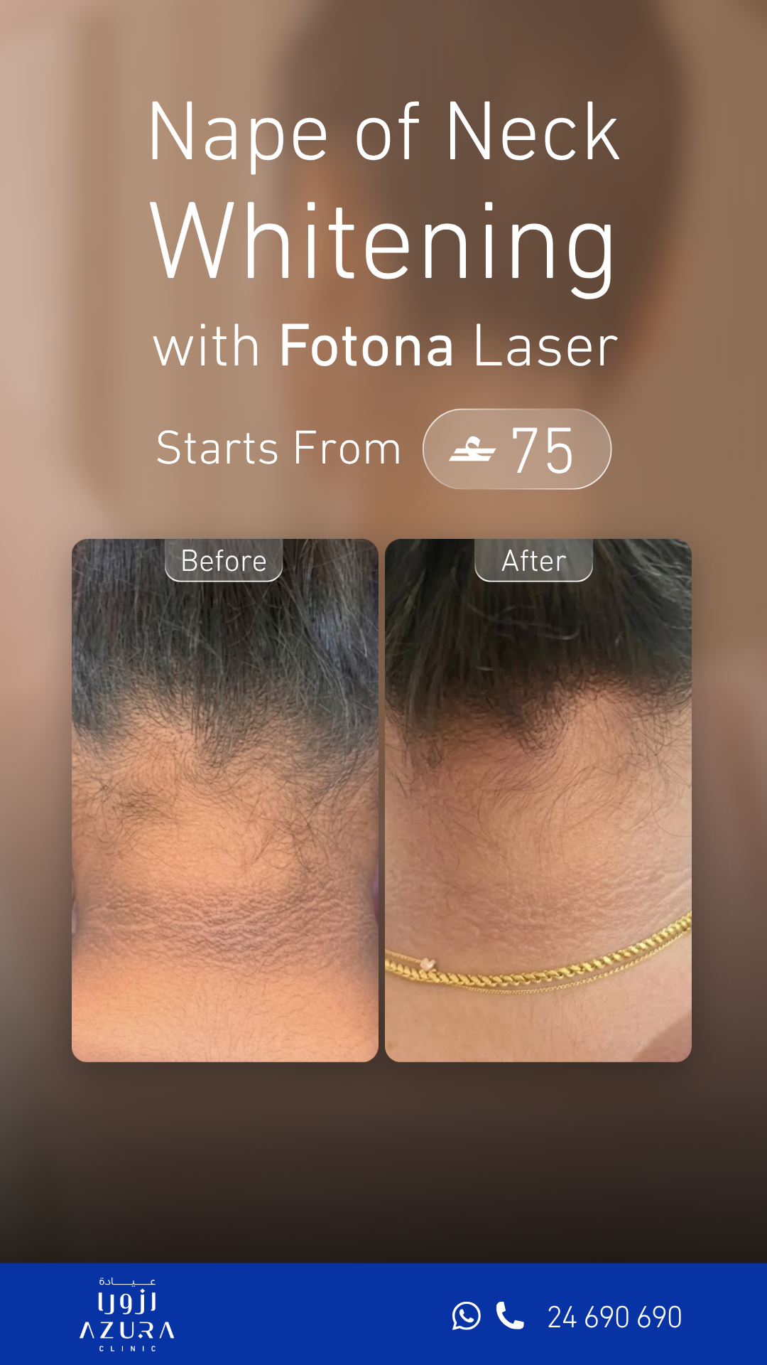 Azura Clinic Facebook ad