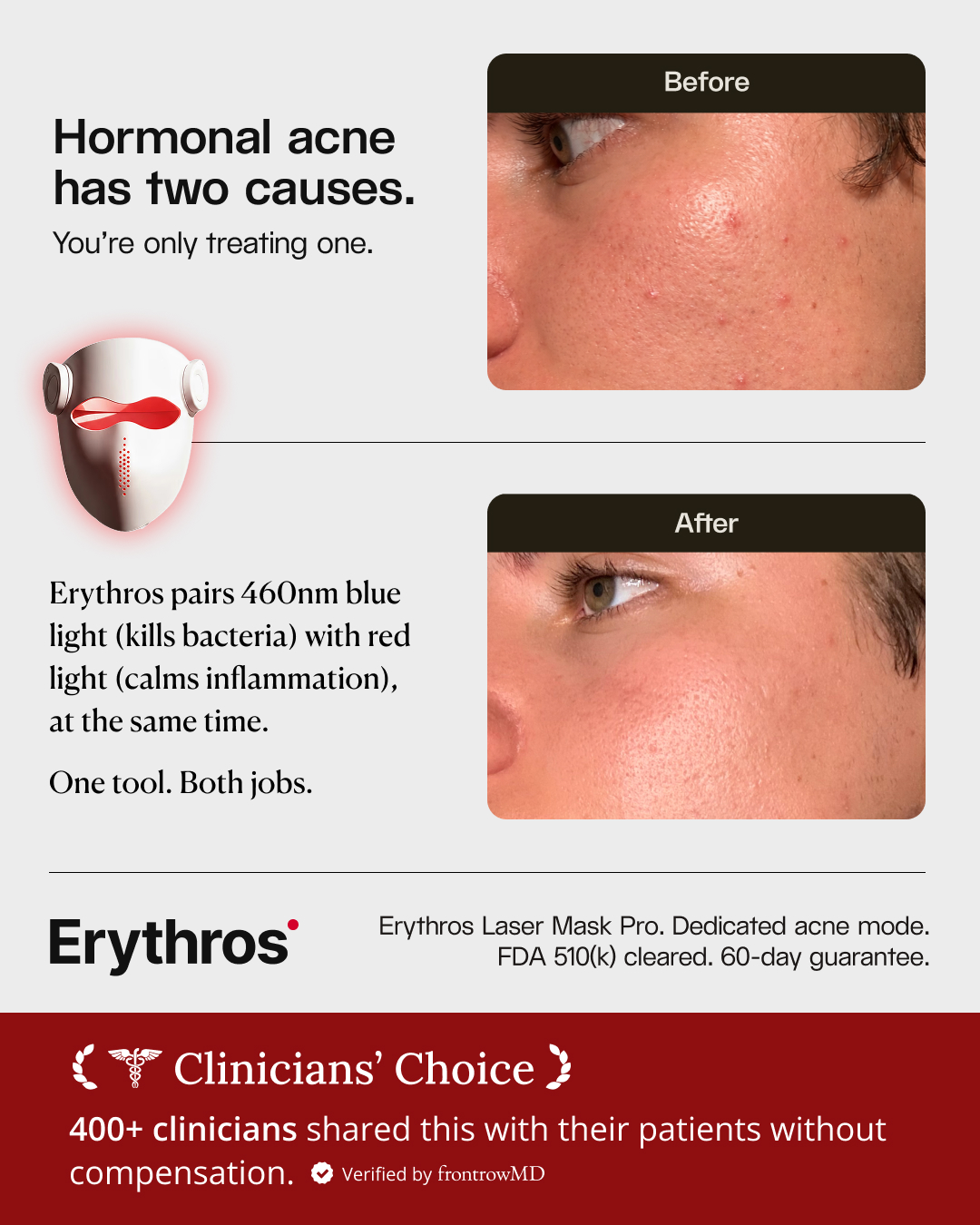 ErythrosLight Facebook ad