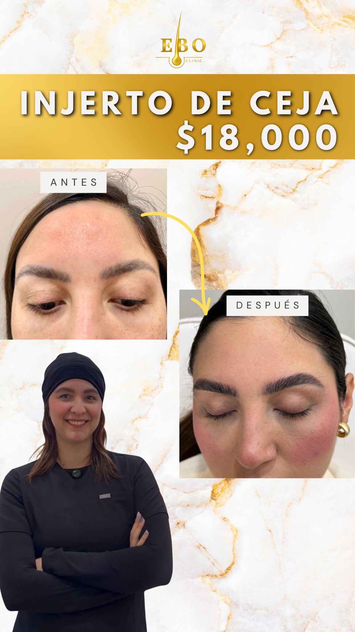 EBO Clinic Facebook ad