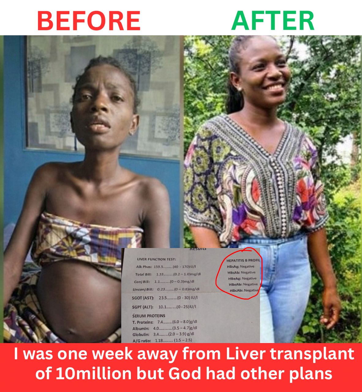 Litox herbal tea Facebook ad: NATURAL EFFECTIVE REMEDY FOR HEPATITIS, BURNING RASH…