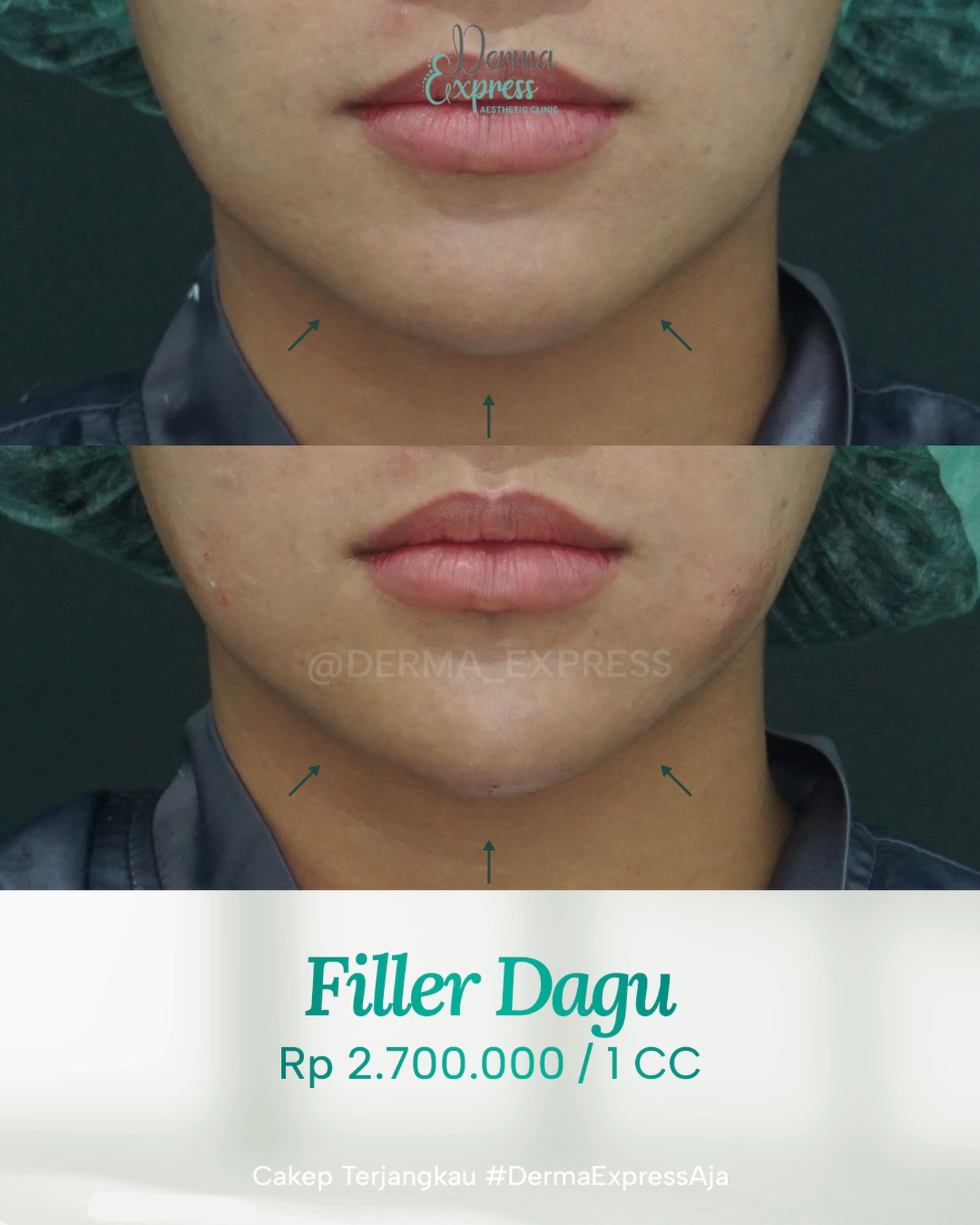 derma_express Facebook ad
