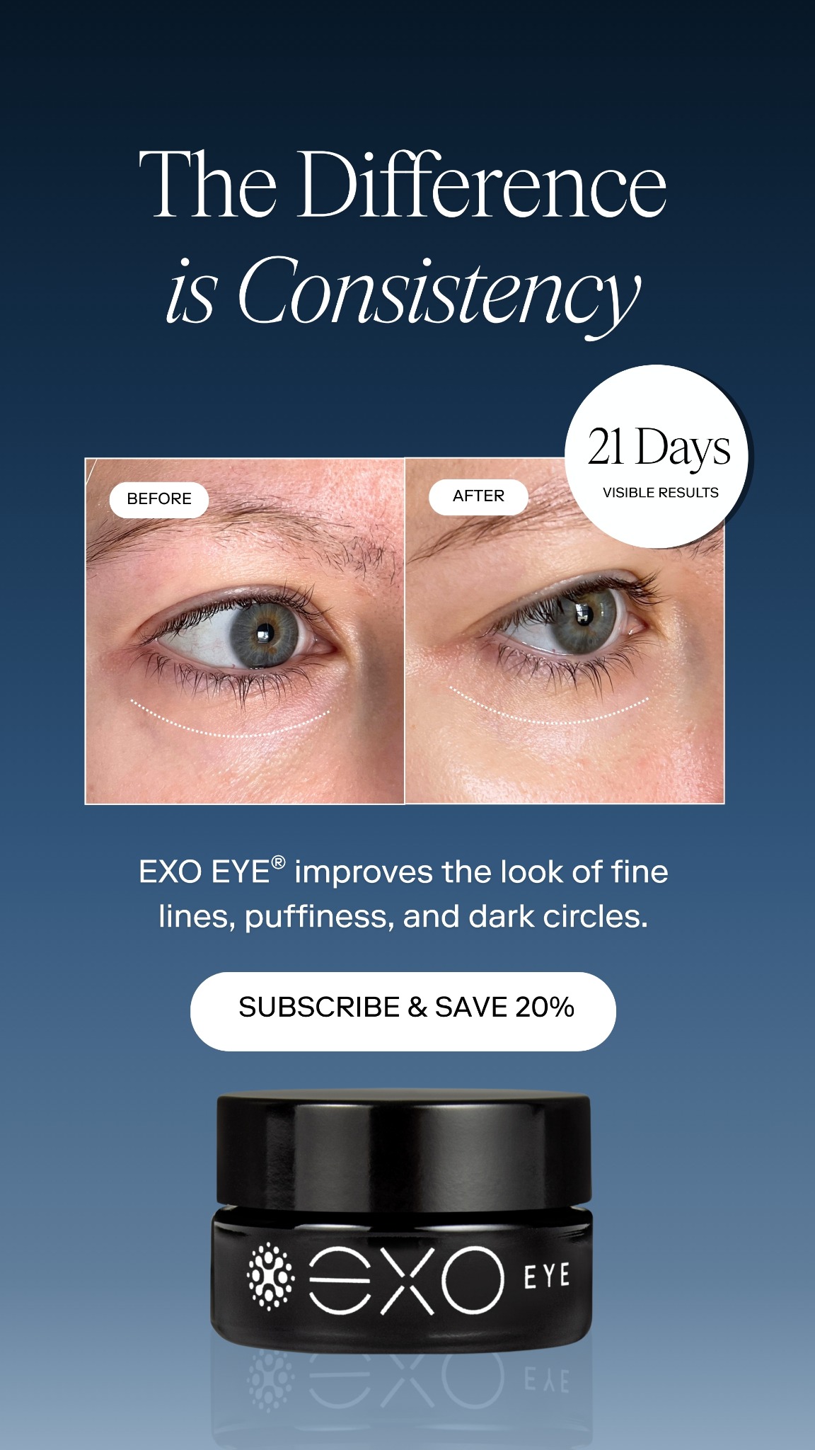 Exoceuticals Facebook ad
