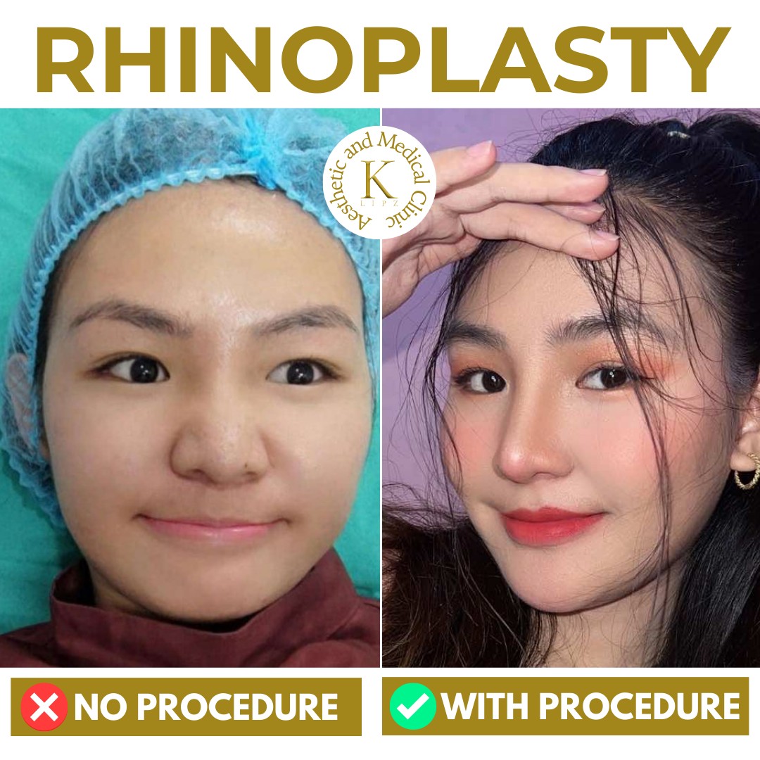 K Aesthetic and Medical Clinic Facebook ad