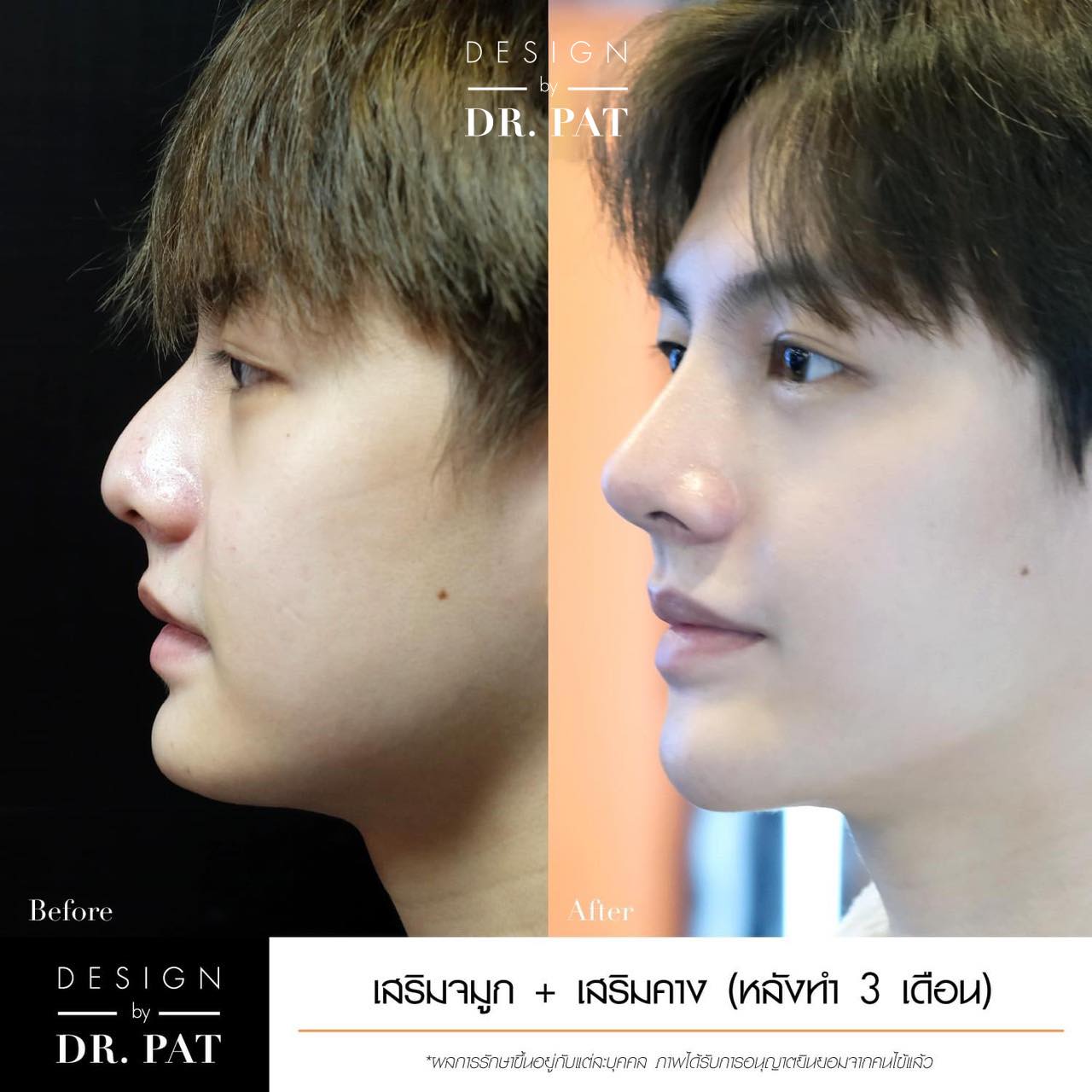 Wellness Center by Bangkok clinic Facebook ad: 𝐒𝐞𝐦𝐢 𝐎𝐩𝐞𝐧 𝐎𝐫𝐢𝐠𝐢𝐧𝐚𝐥