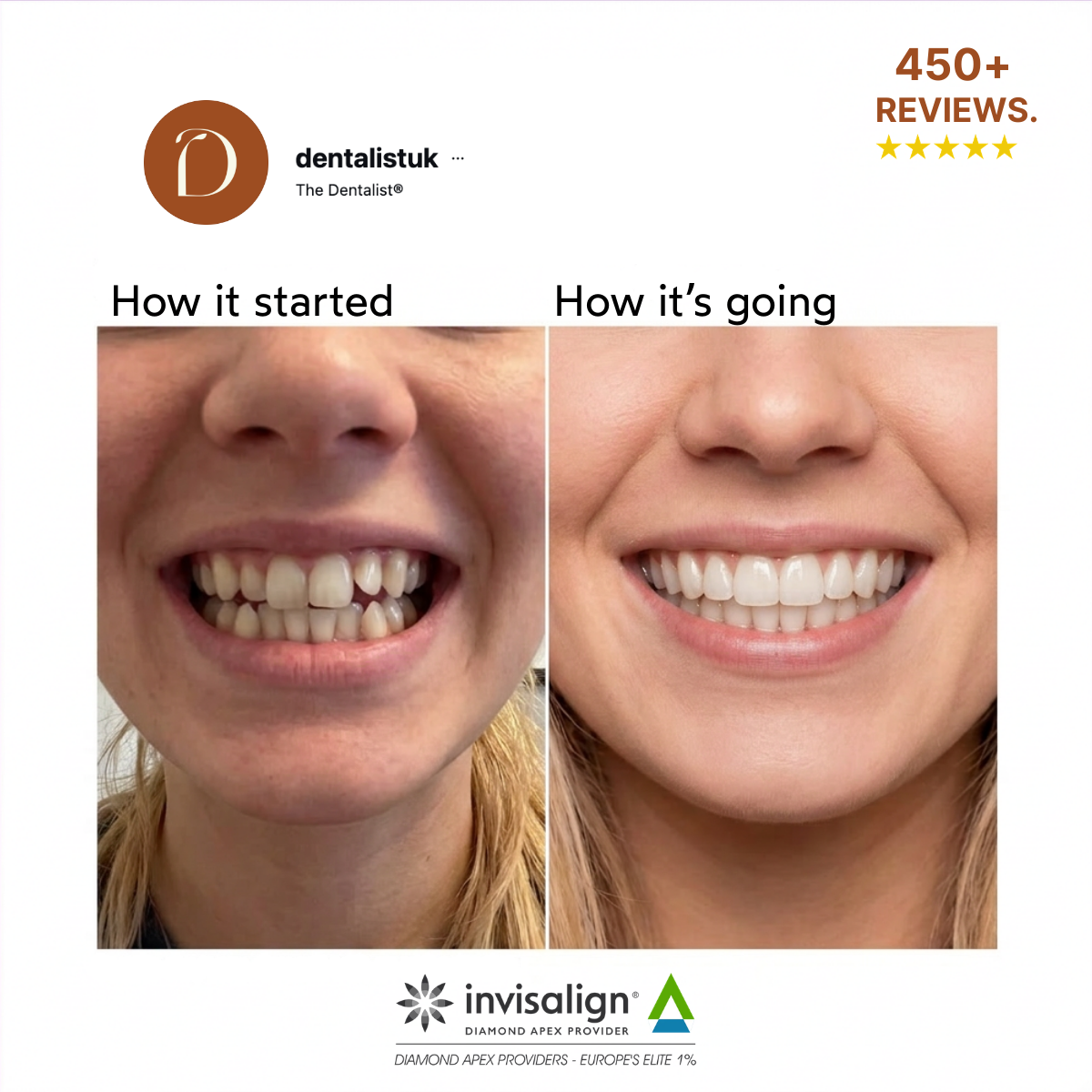 The Dentalist Facebook ad