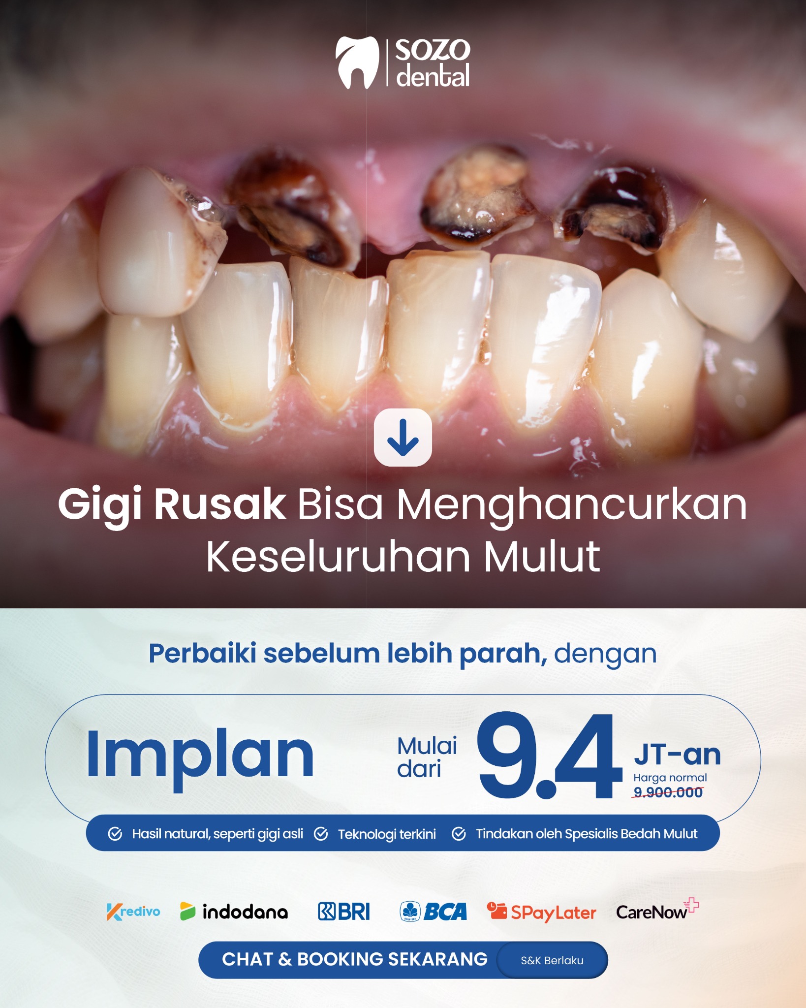 Sozo Dental Clinic Facebook ad