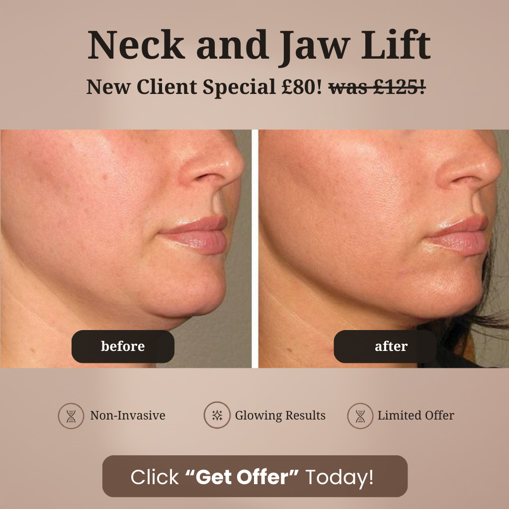 ML.aesthetics.sc Facebook ad: RF Microneedling £80 Was £125!