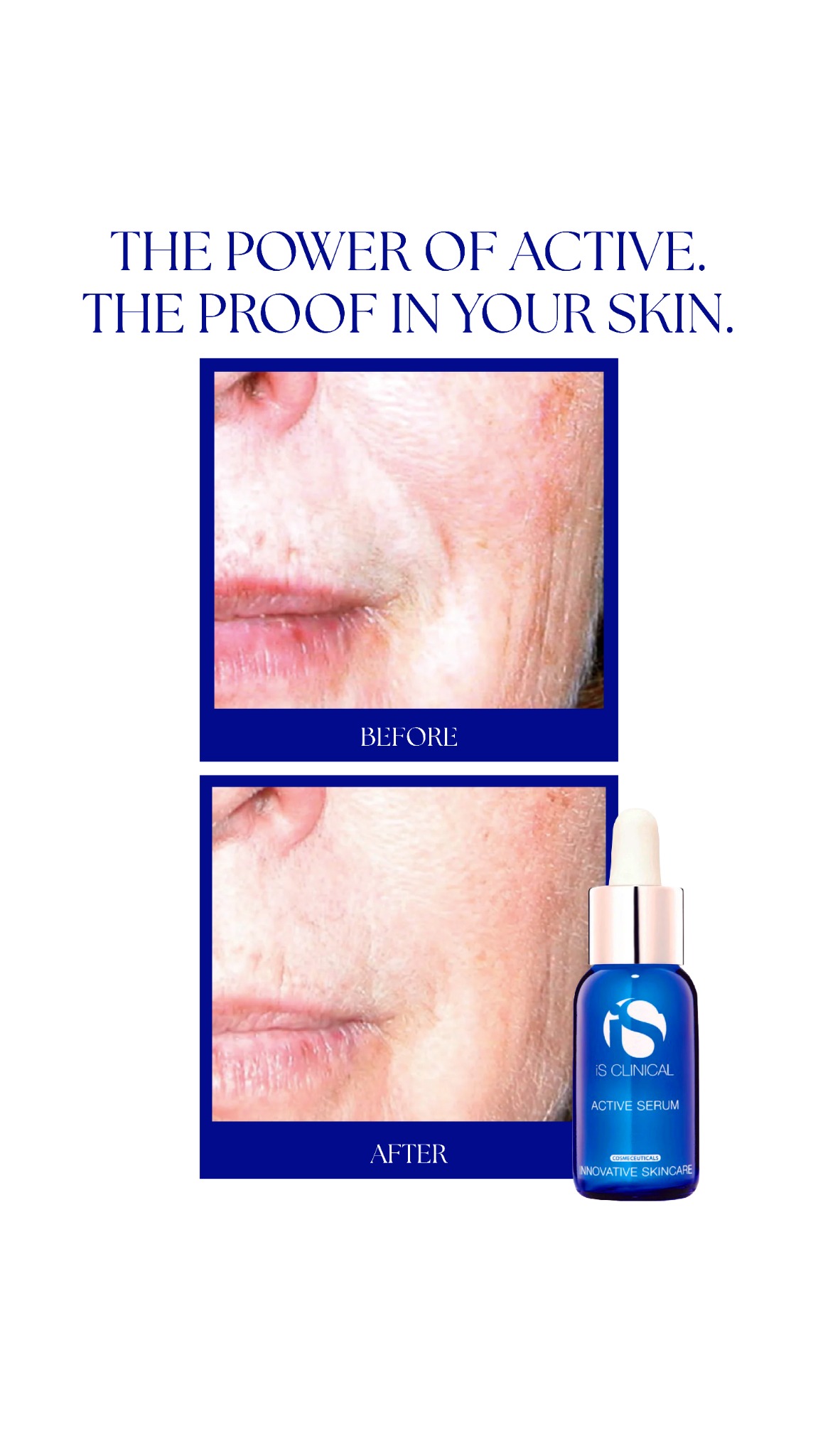iS Clinical UK Facebook ad from Jan 20, 2026