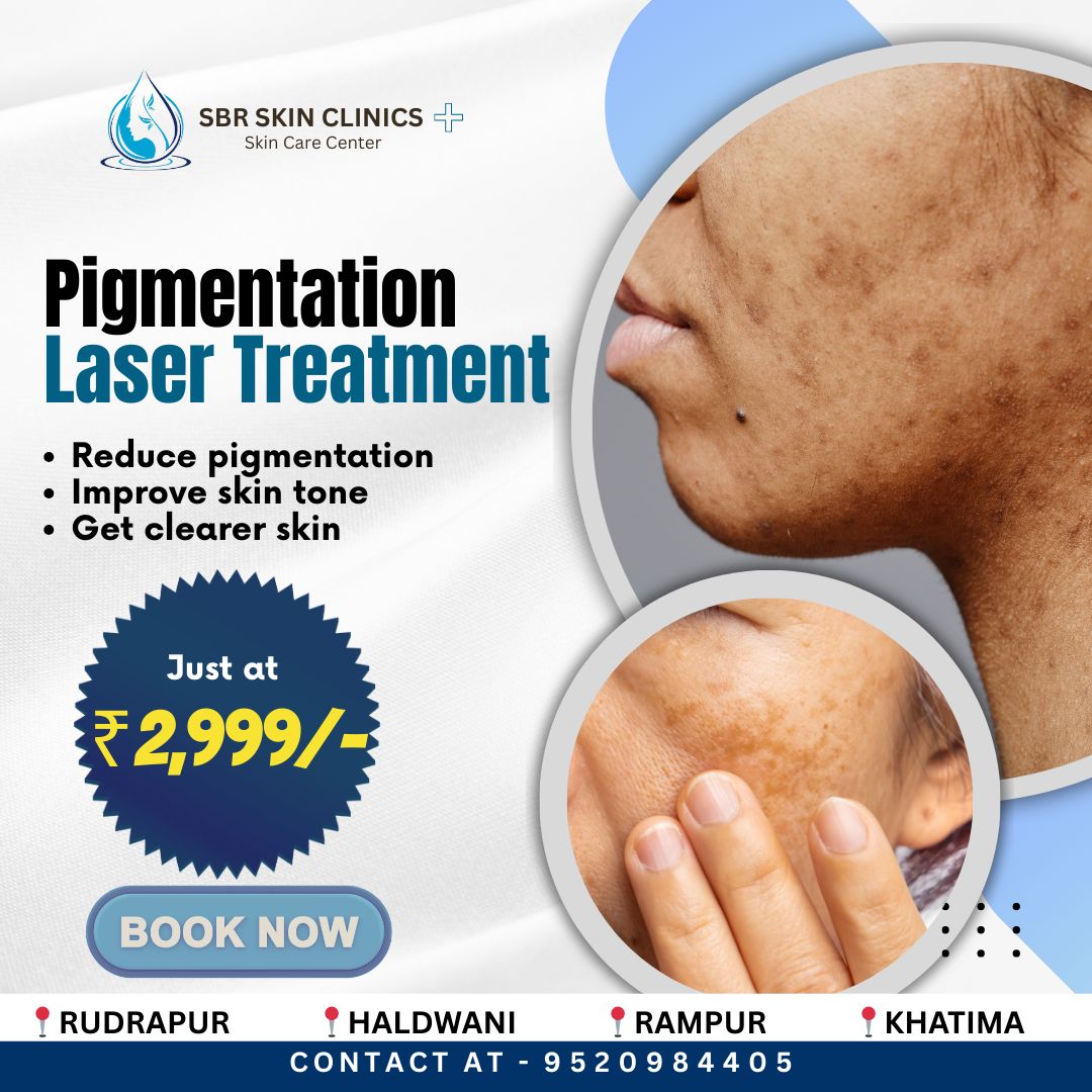 SBR Skin Clinics Facebook ad: BOOK YOUR APPOINTMENT NOW