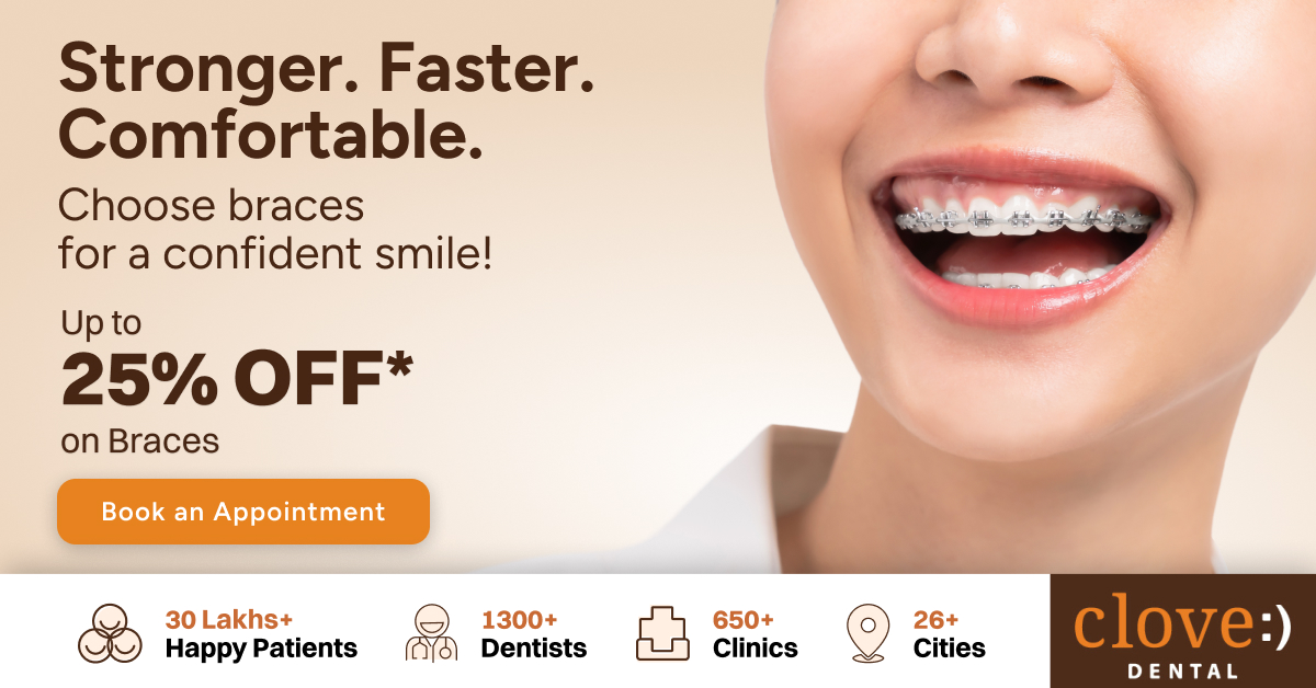 Clove Dental Facebook ad