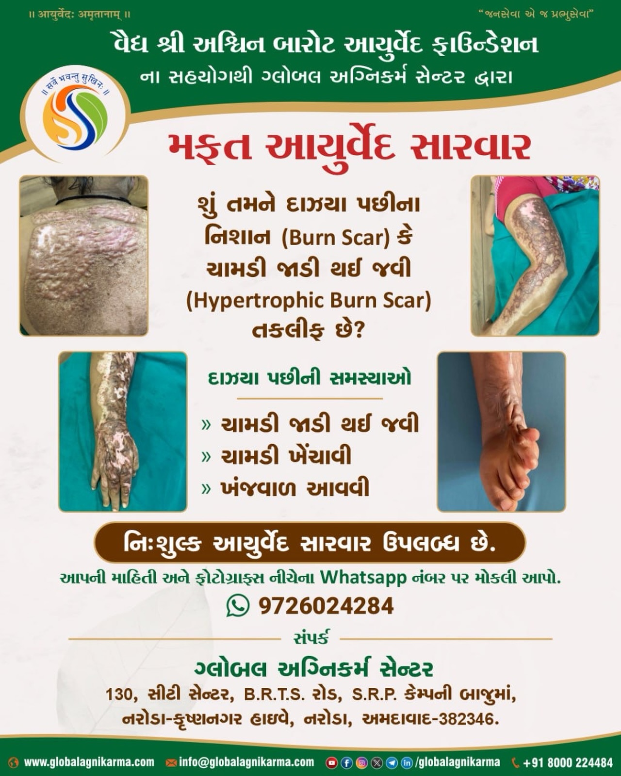 Global Agnikarma Centre Facebook ad: FREE Burn Scar Treatment